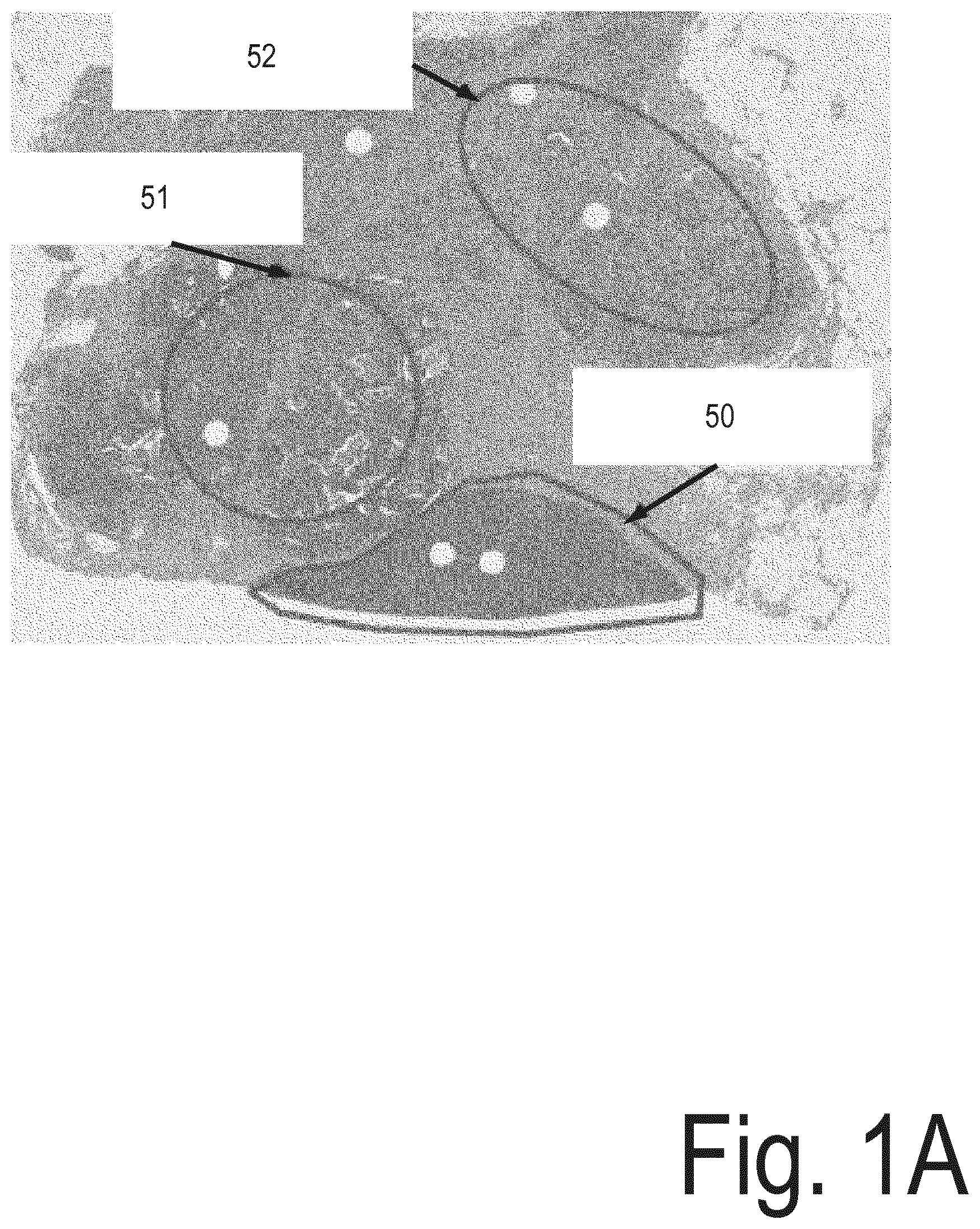 Patent US12100137 Figure 1 – System for analysis of microscopic data using graphs
