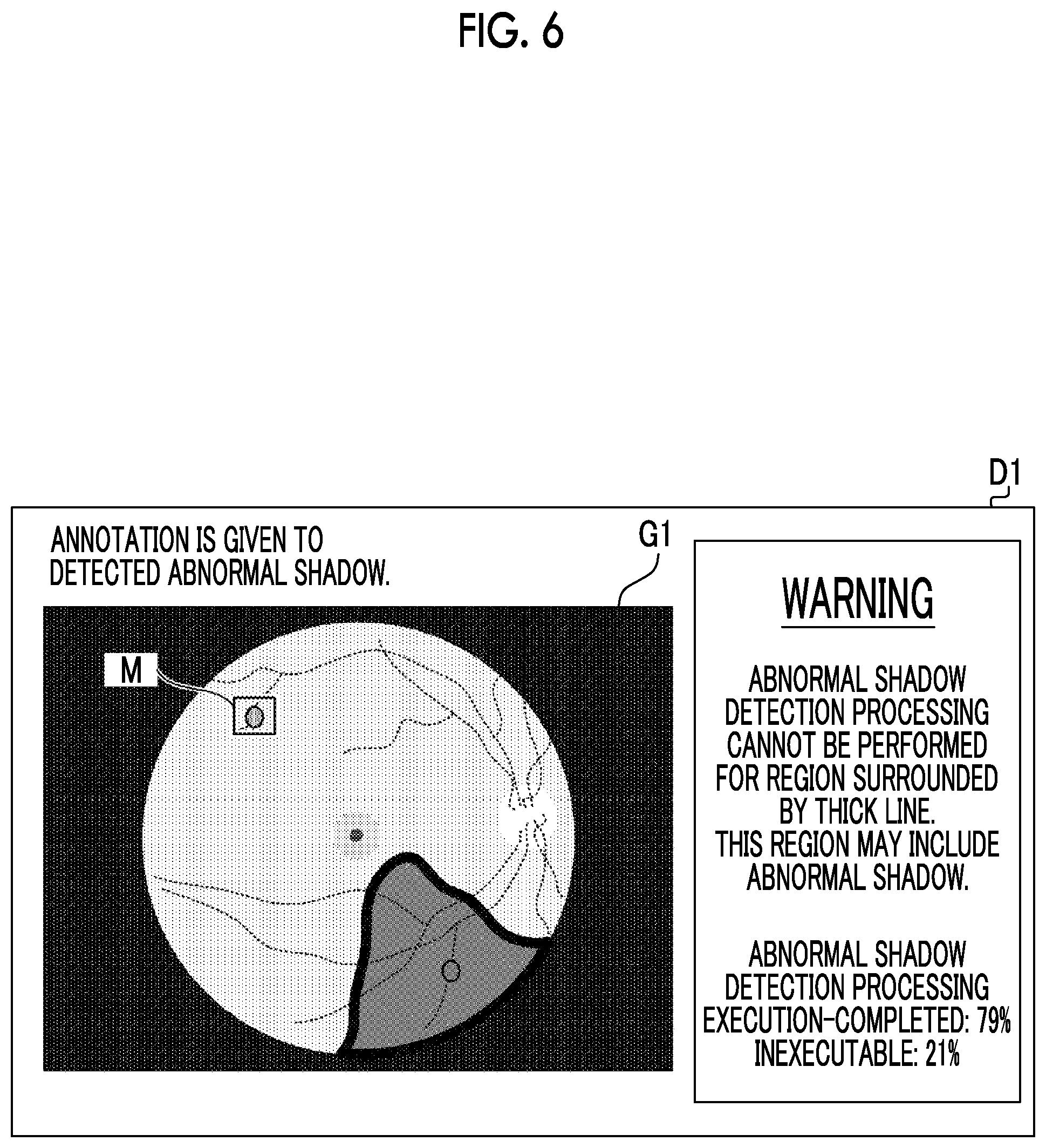 Patent US12100140 Figure 4 – Information processing apparatus, information processing method, and information processing program