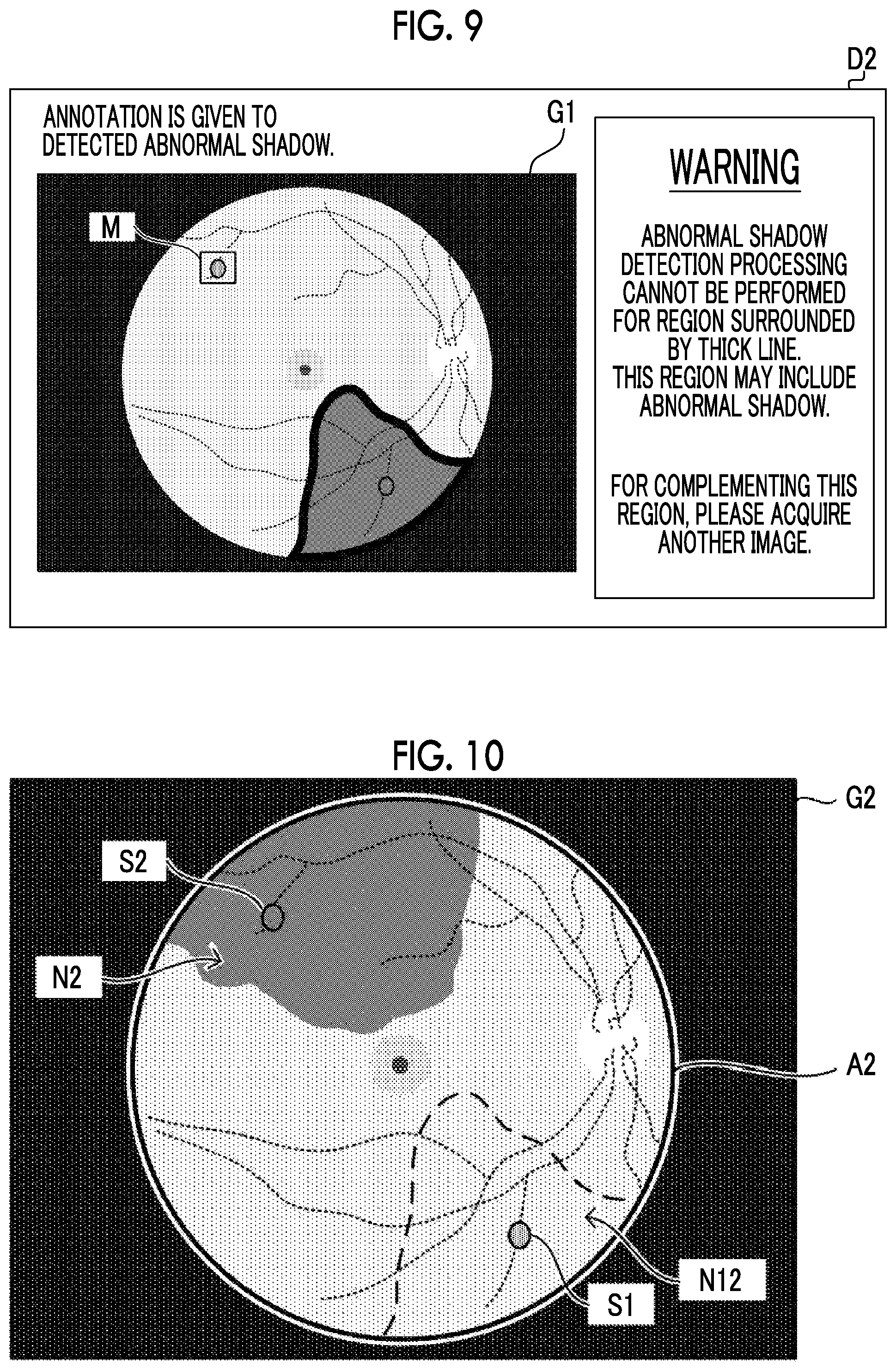 Patent US12100140 Figure 7 – Information processing apparatus, information processing method, and information processing program