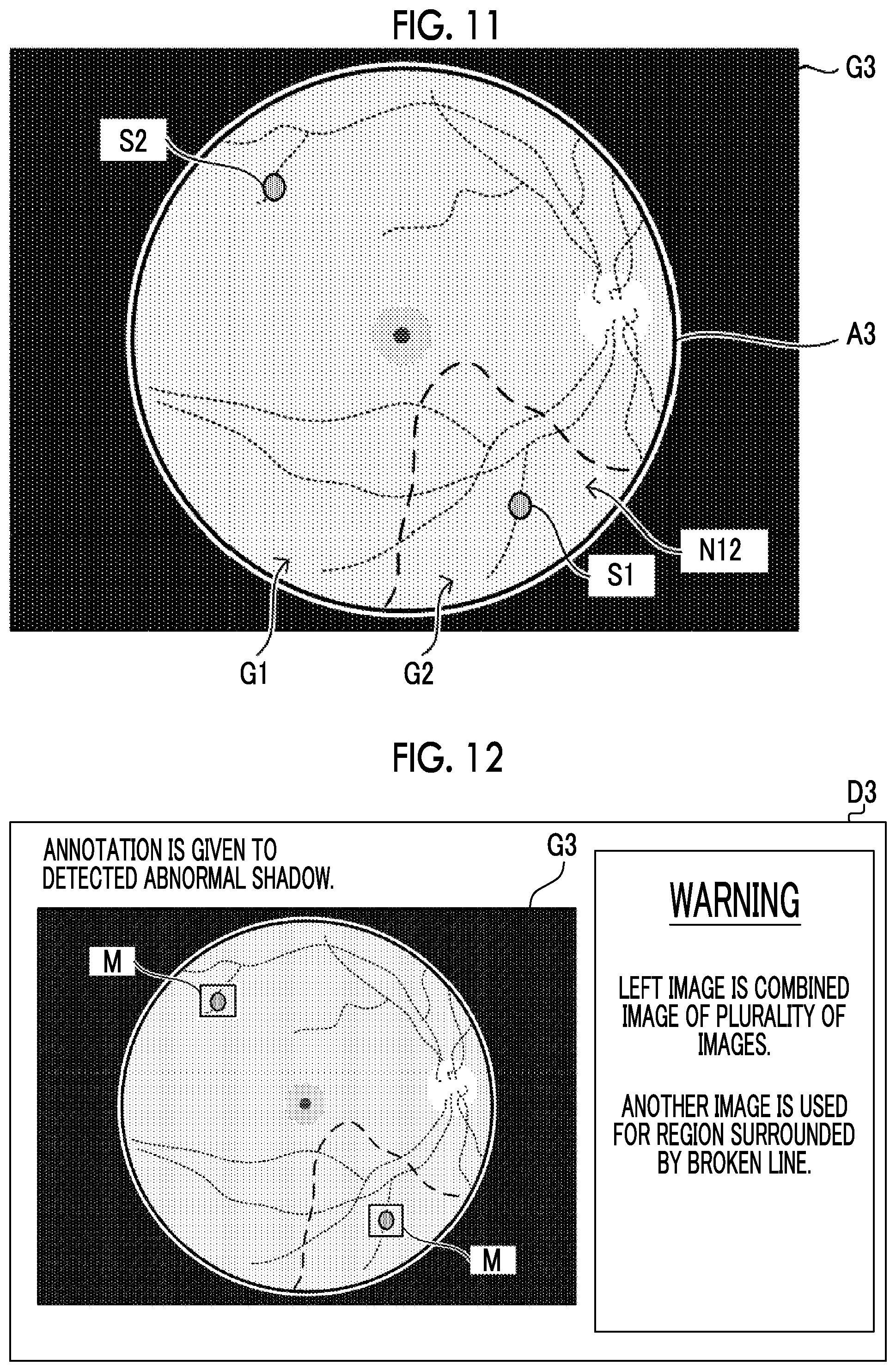 Patent US12100140 Figure 8 – Information processing apparatus, information processing method, and information processing program