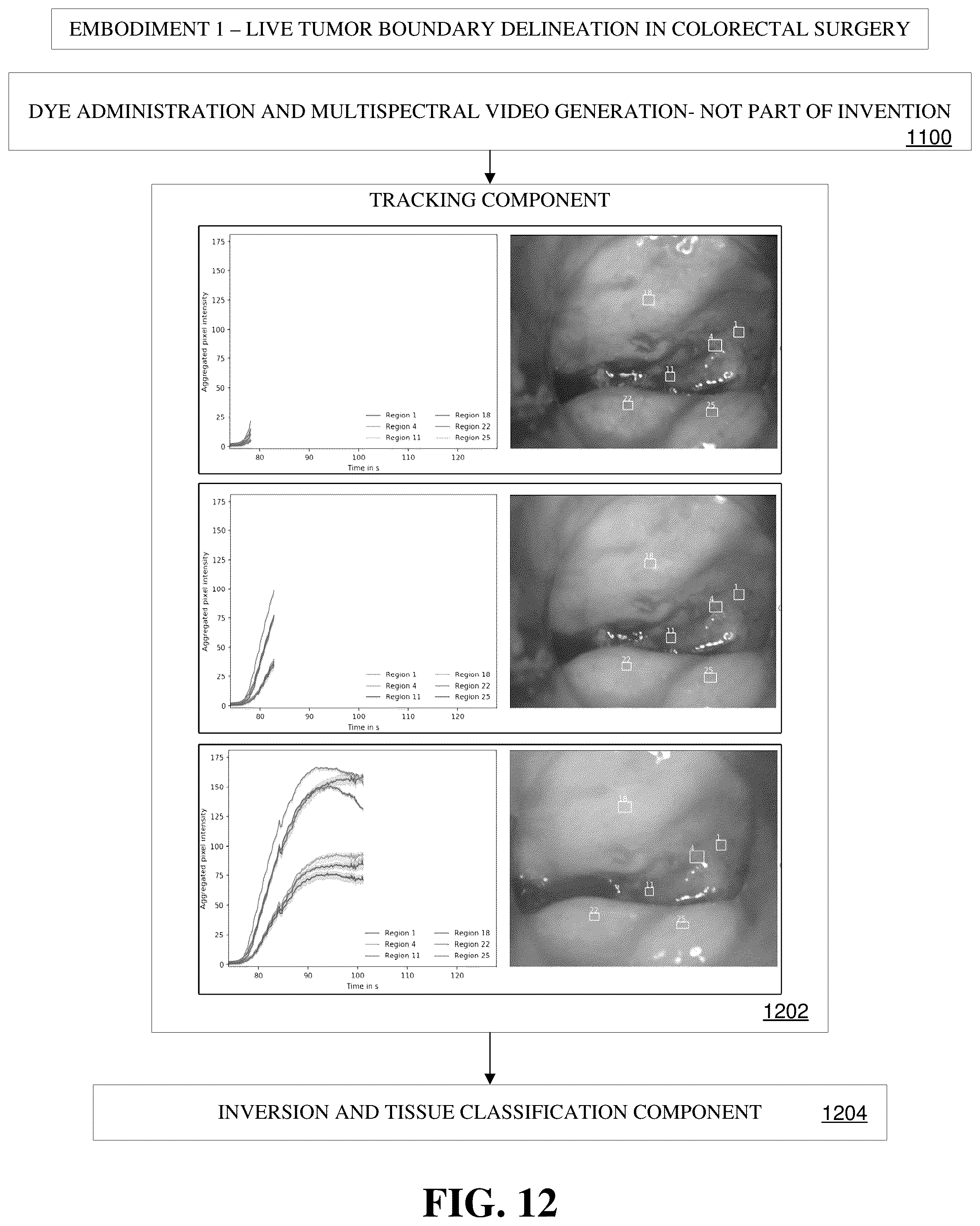 Patent US12100141 Figure 12 – Three-dimensional delineation of tumor boundaries via supervised machine learning algorithms and augmented reality