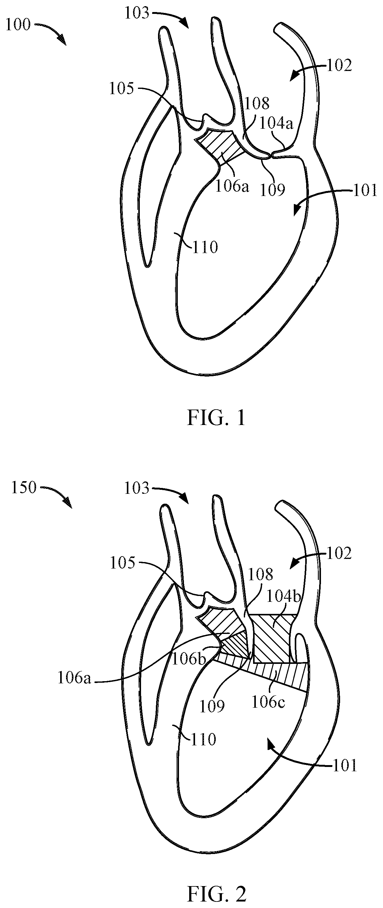 Patent US12100142 Figure 1 – System and method of evaluating fluid and air flow