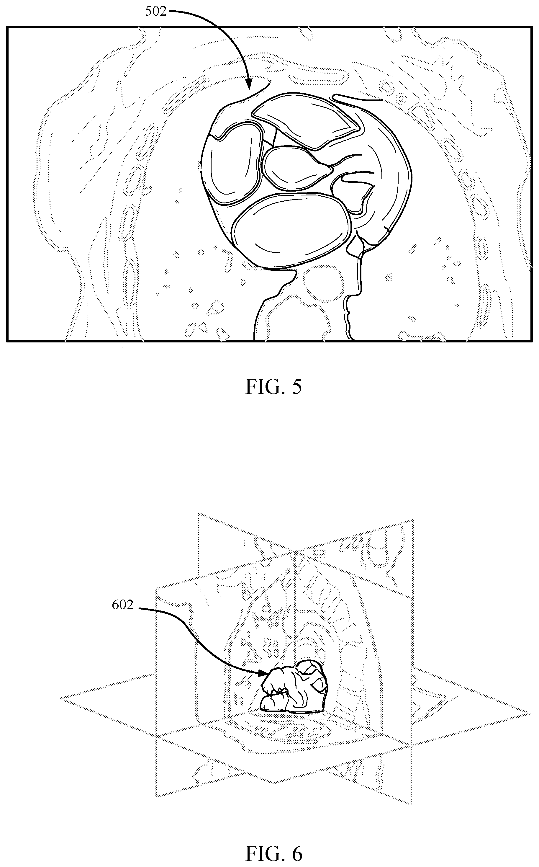 Patent US12100142 Figure 4 – System and method of evaluating fluid and air flow