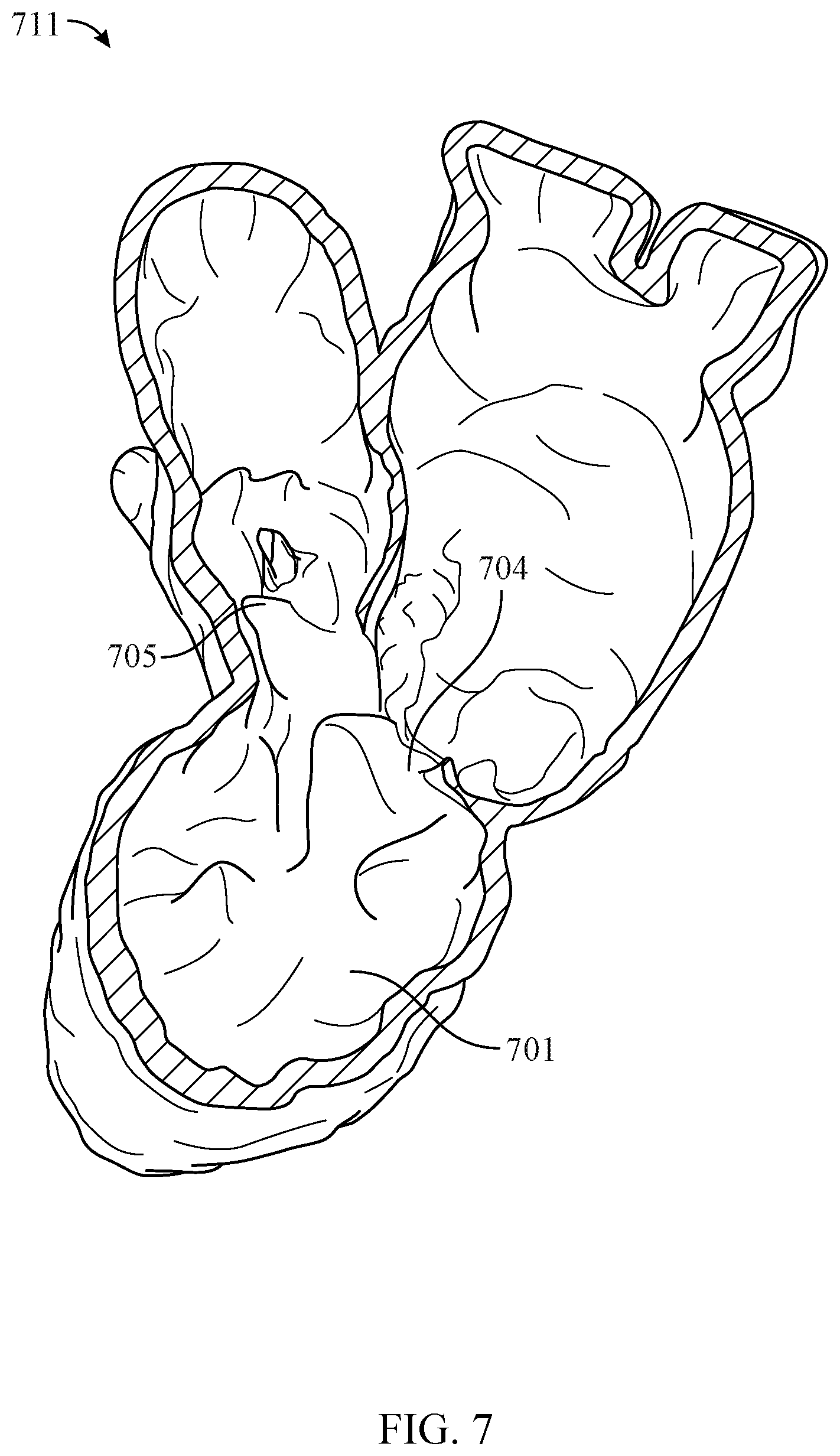 Patent US12100142 Figure 5 – System and method of evaluating fluid and air flow