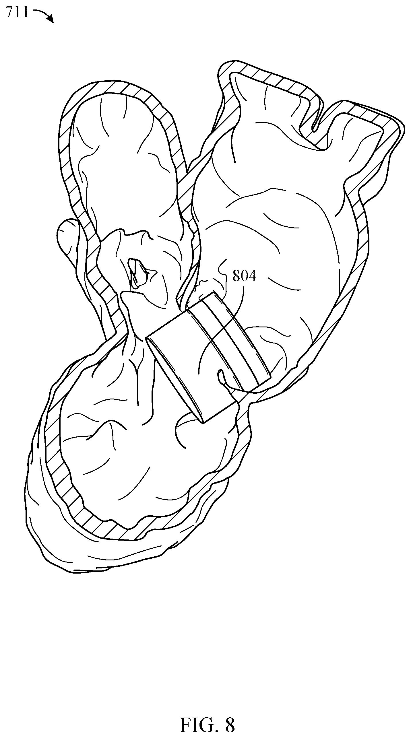 Patent US12100142 Figure 6 – System and method of evaluating fluid and air flow