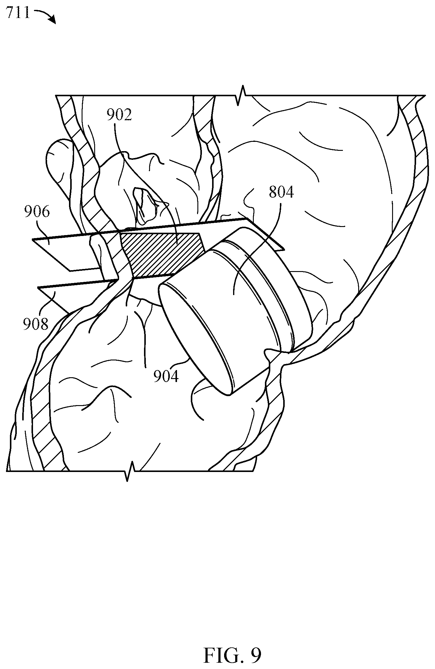 Patent US12100142 Figure 7 – System and method of evaluating fluid and air flow