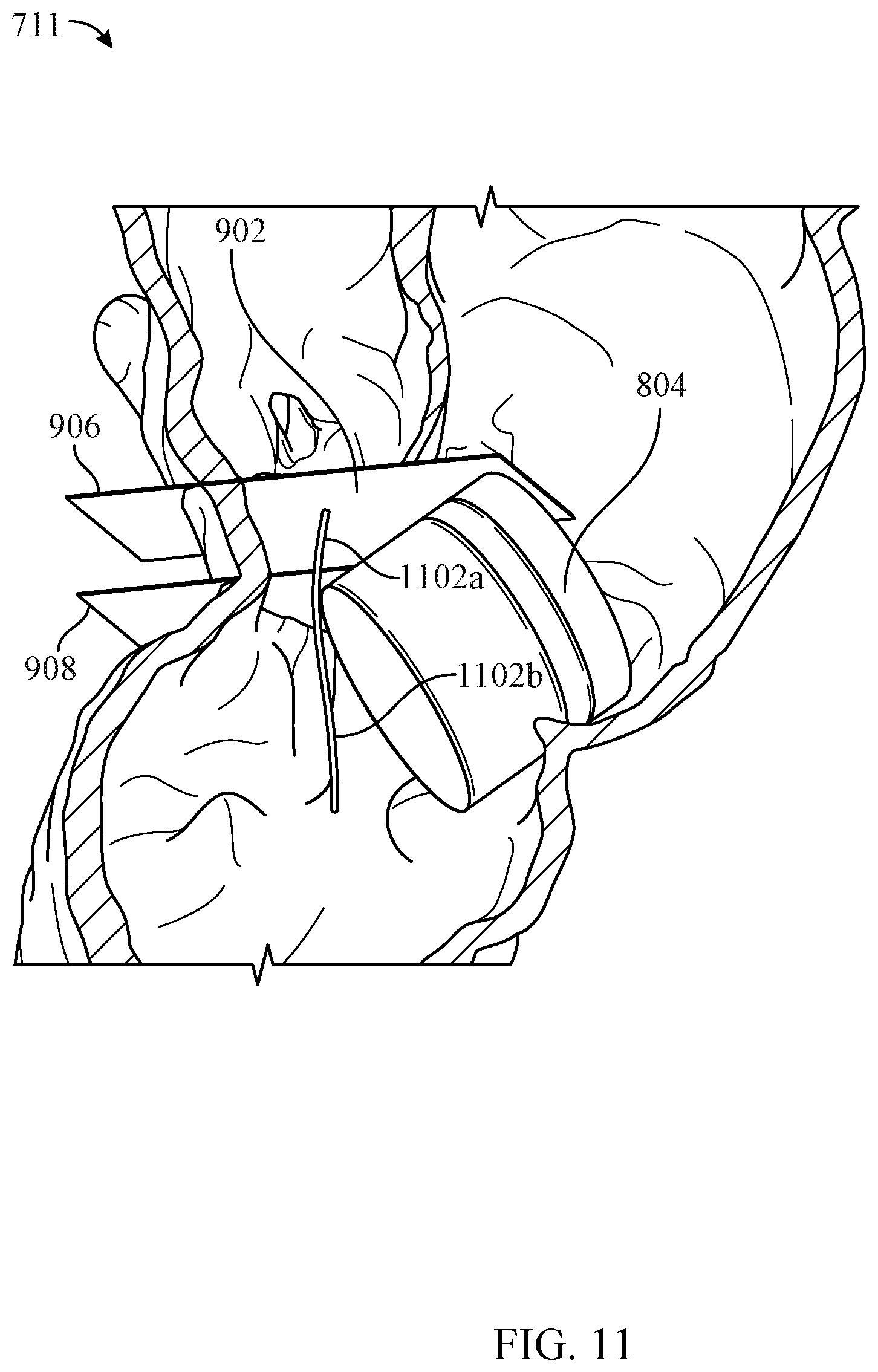 Patent US12100142 Figure 9 – System and method of evaluating fluid and air flow