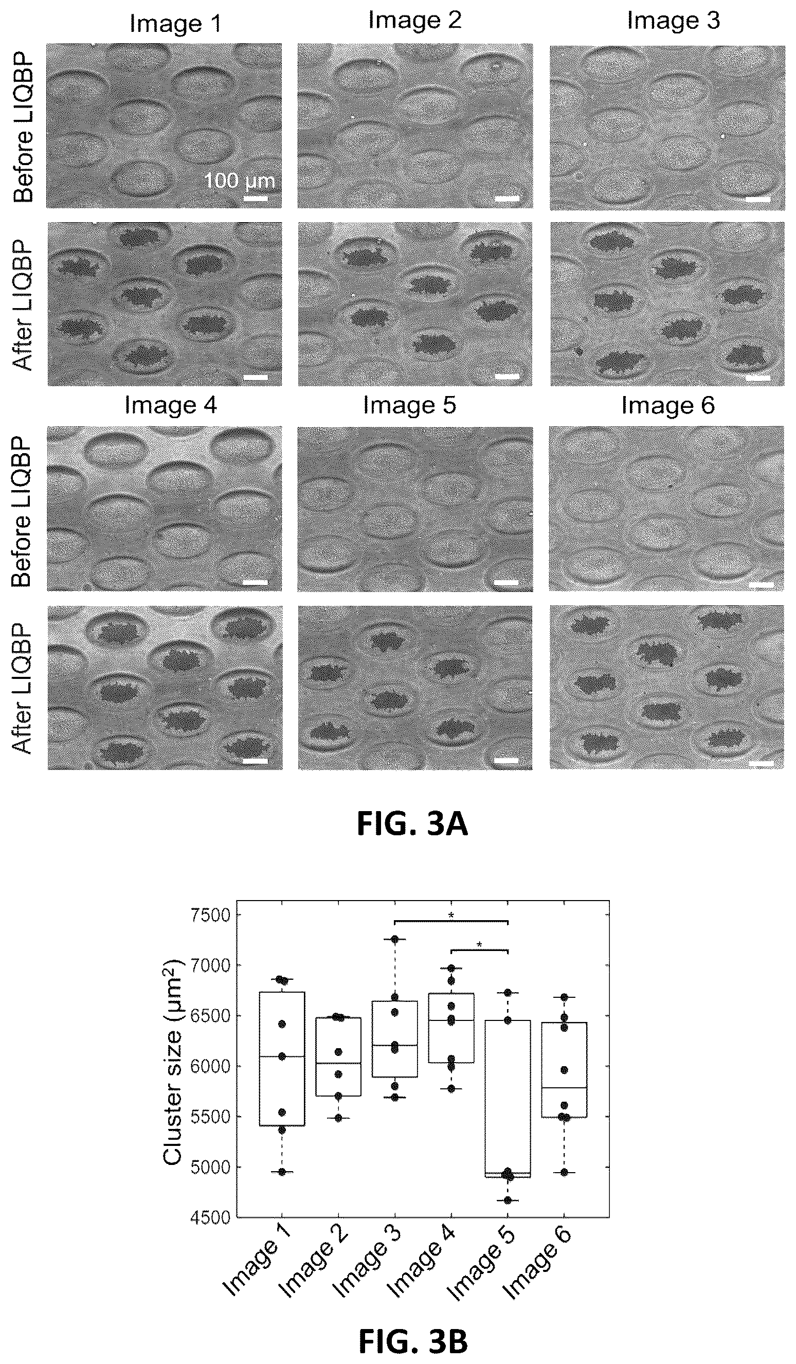 Patent US12100143 Figure 4 – Label-free liquid biopsy-based disease model, analytical platform and method for predicting disease prognosis