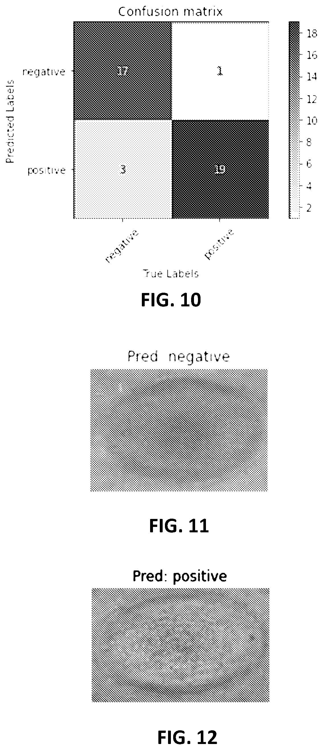 Patent US12100143 Figure 15 – Label-free liquid biopsy-based disease model, analytical platform and method for predicting disease prognosis