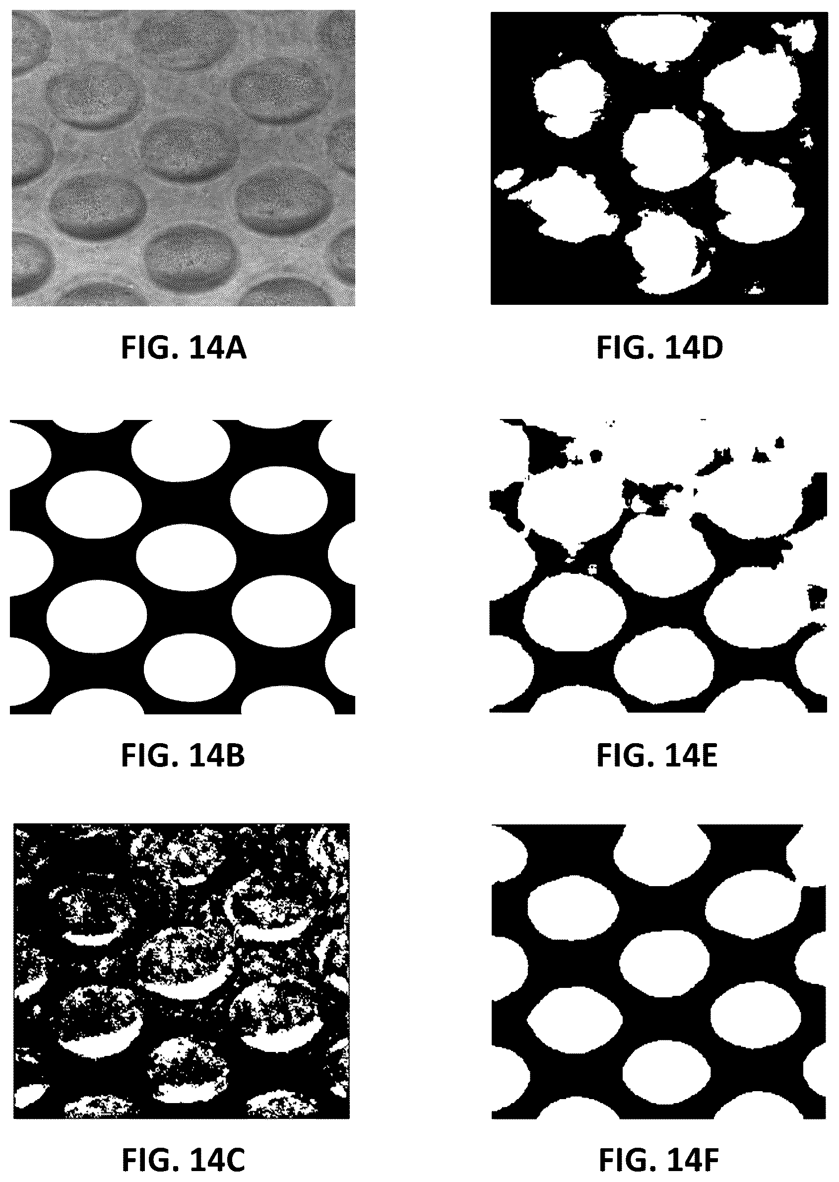 Patent US12100143 Figure 18 – Label-free liquid biopsy-based disease model, analytical platform and method for predicting disease prognosis