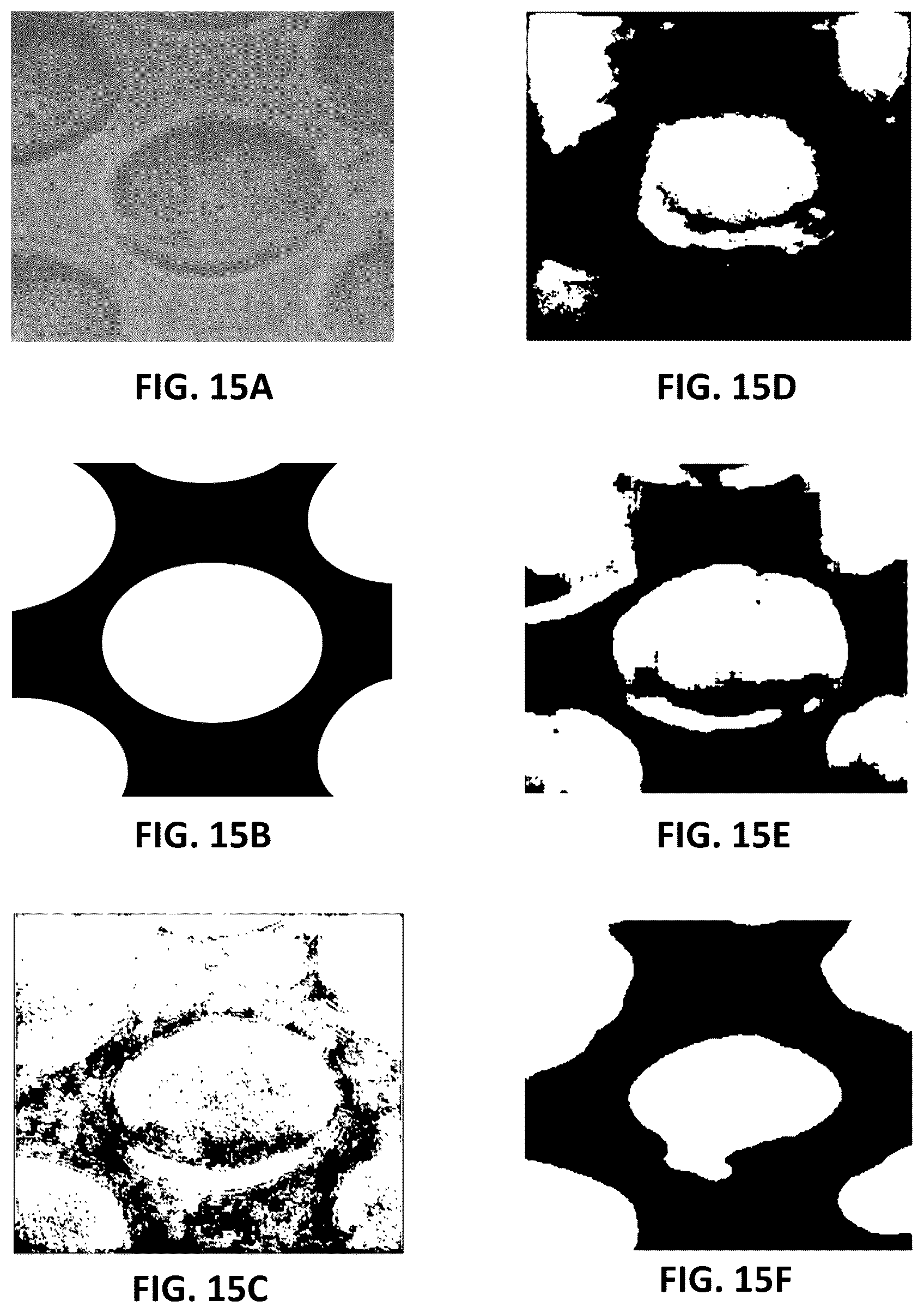 Patent US12100143 Figure 19 – Label-free liquid biopsy-based disease model, analytical platform and method for predicting disease prognosis