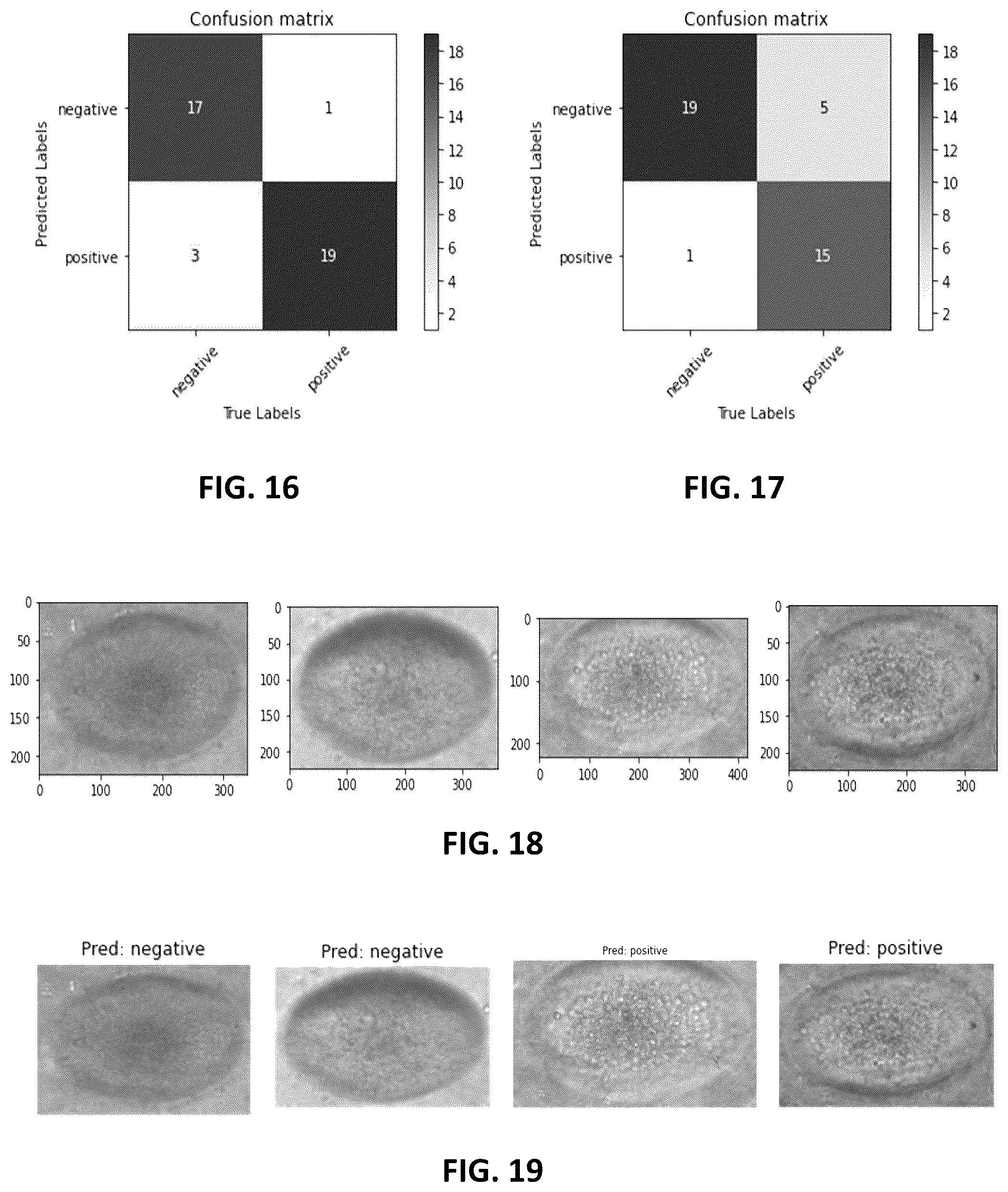 Patent US12100143 Figure 20 – Label-free liquid biopsy-based disease model, analytical platform and method for predicting disease prognosis