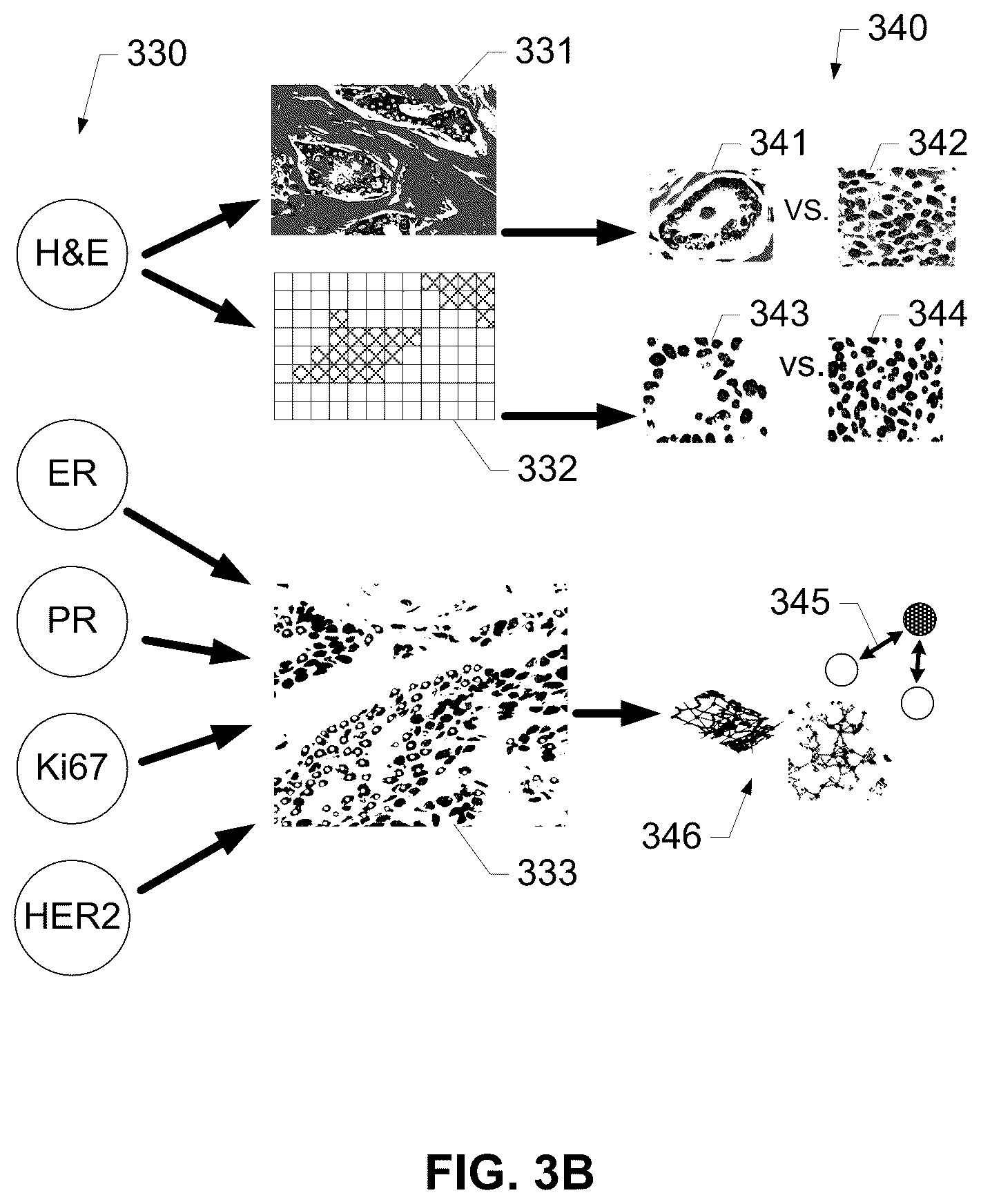 Patent US12100146 Figure 4 – Assessing risk of breast cancer recurrence