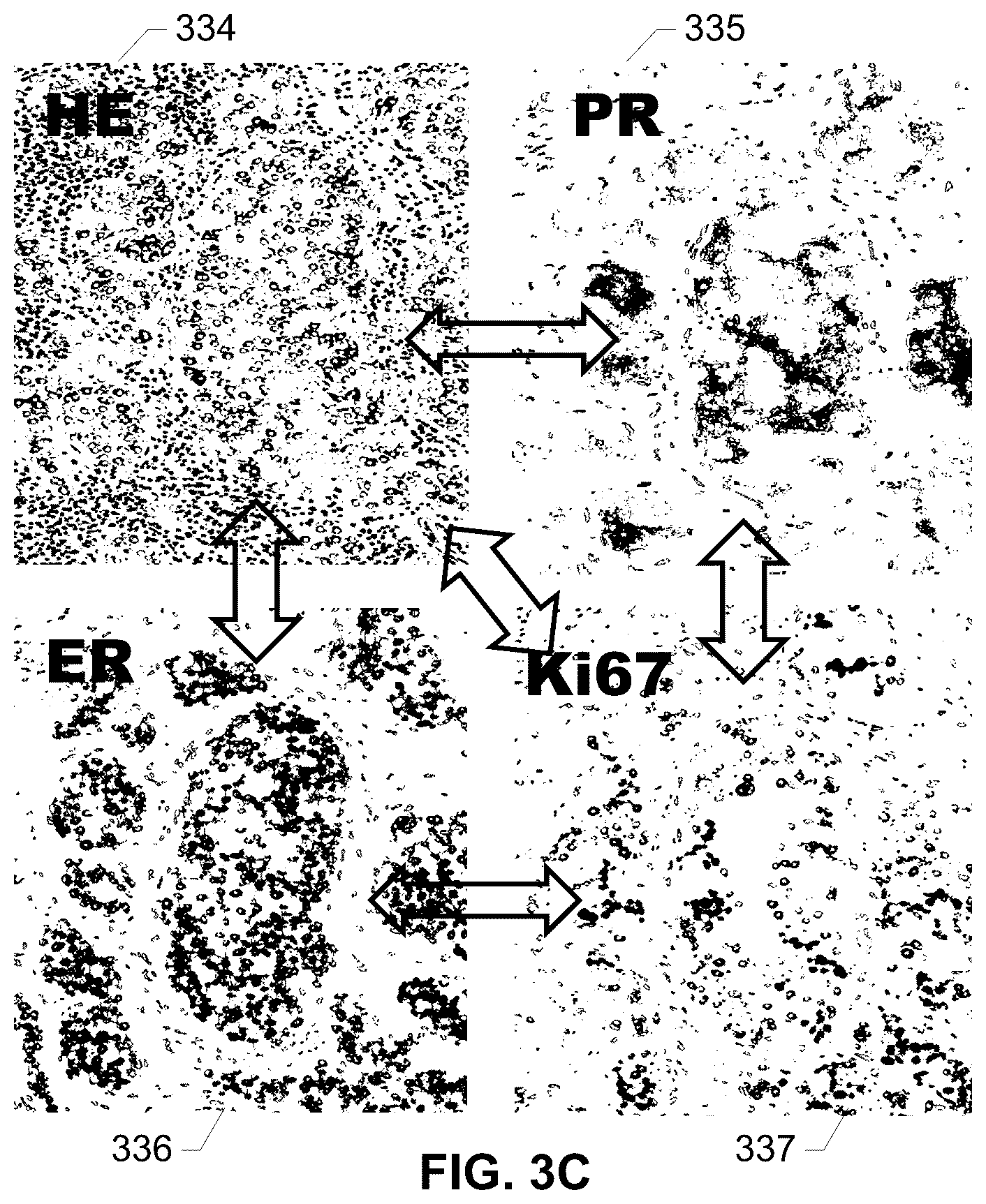 Patent US12100146 Figure 5 – Assessing risk of breast cancer recurrence