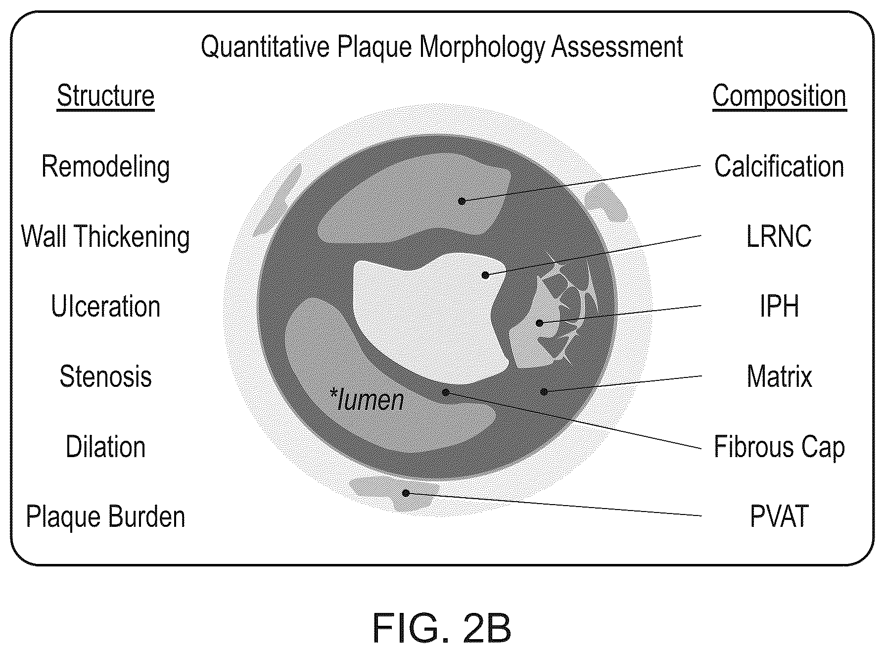 Patent US12100149 Figure 3 – Determining likely response to combination therapies for cardiovascular disease non-invasively