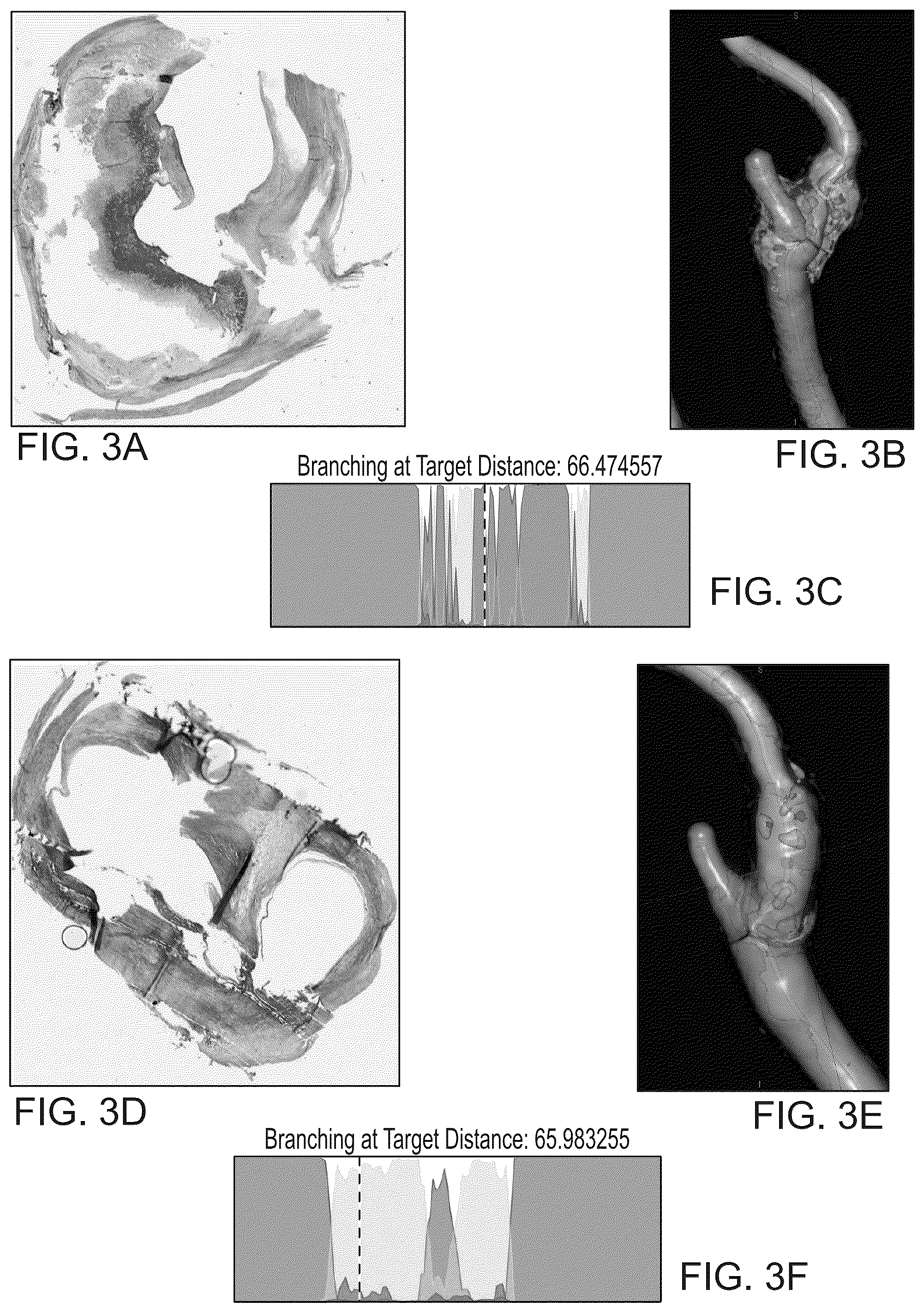 Patent US12100149 Figure 4 – Determining likely response to combination therapies for cardiovascular disease non-invasively