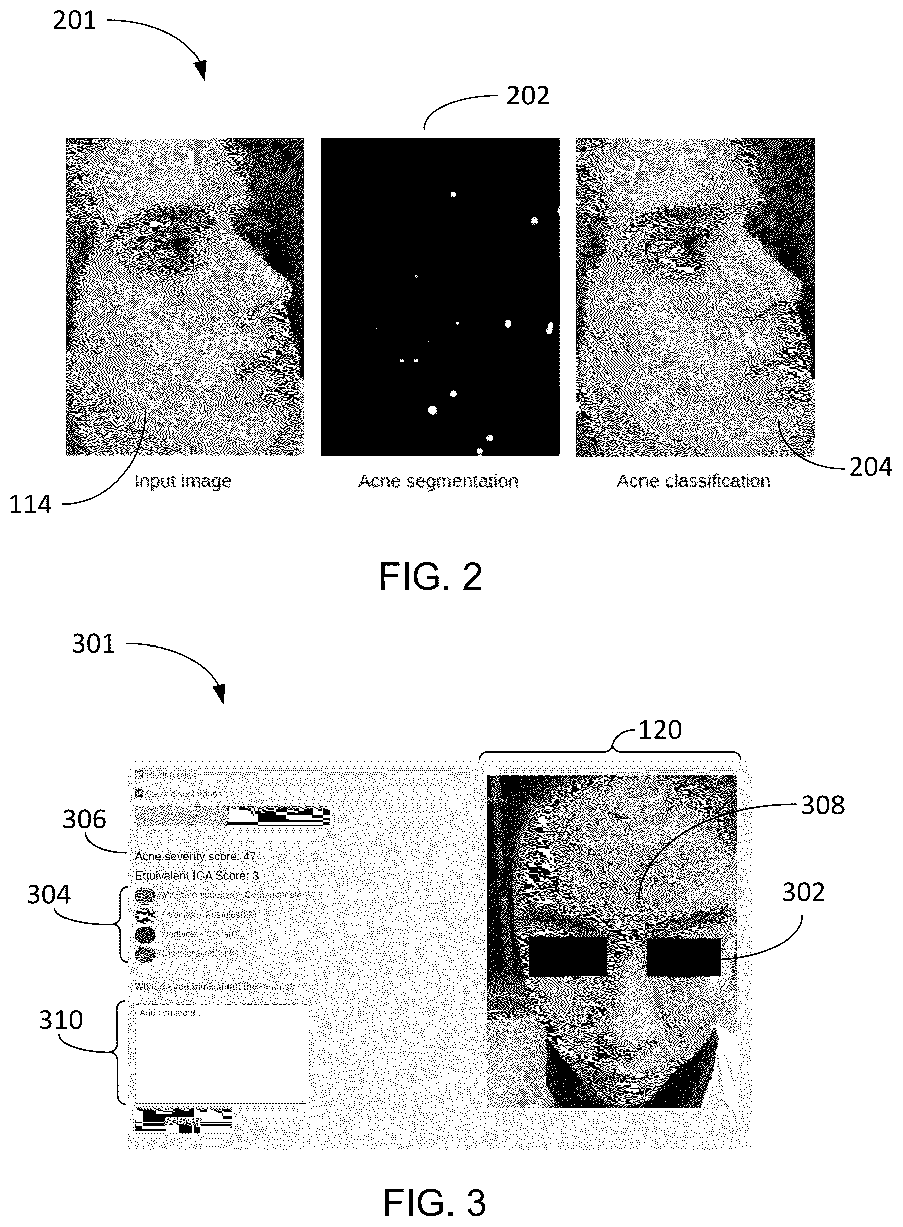 Patent US12100152 Figure 2 – Compute system with acne diagnostic mechanism and method of operation thereof