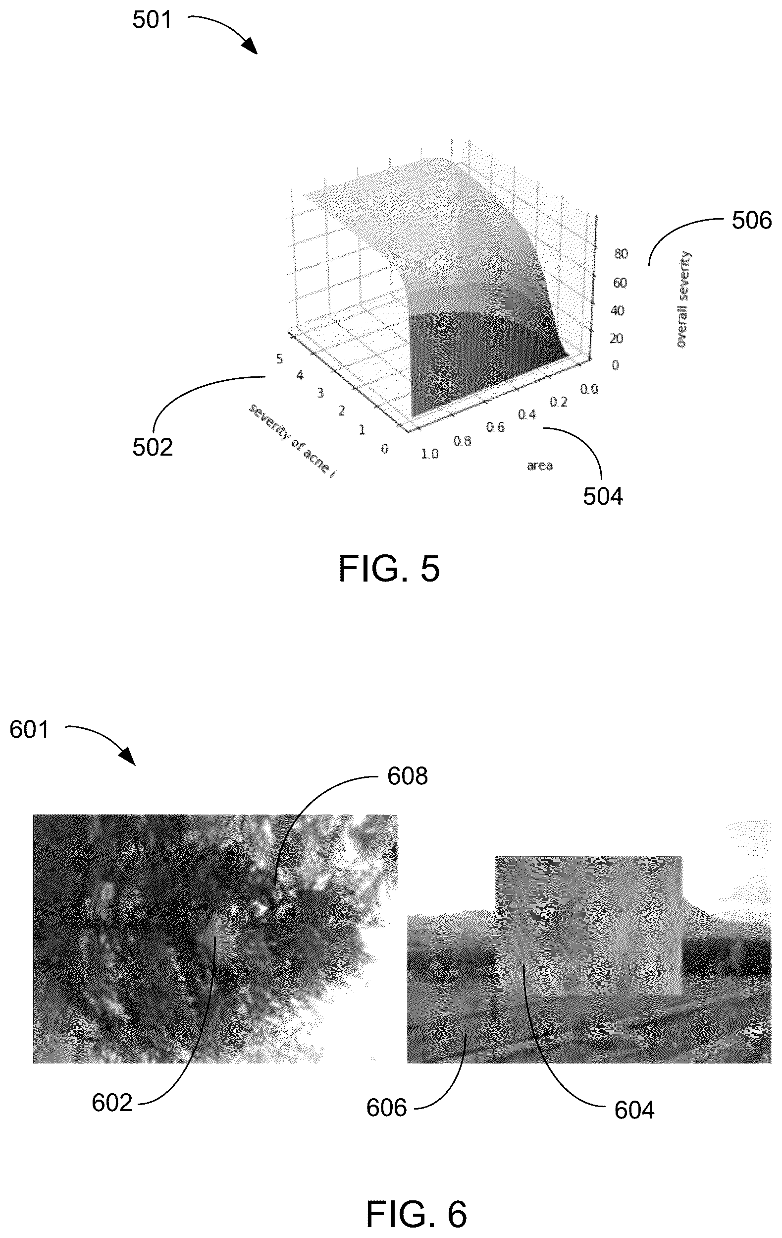 Patent US12100152 Figure 4 – Compute system with acne diagnostic mechanism and method of operation thereof