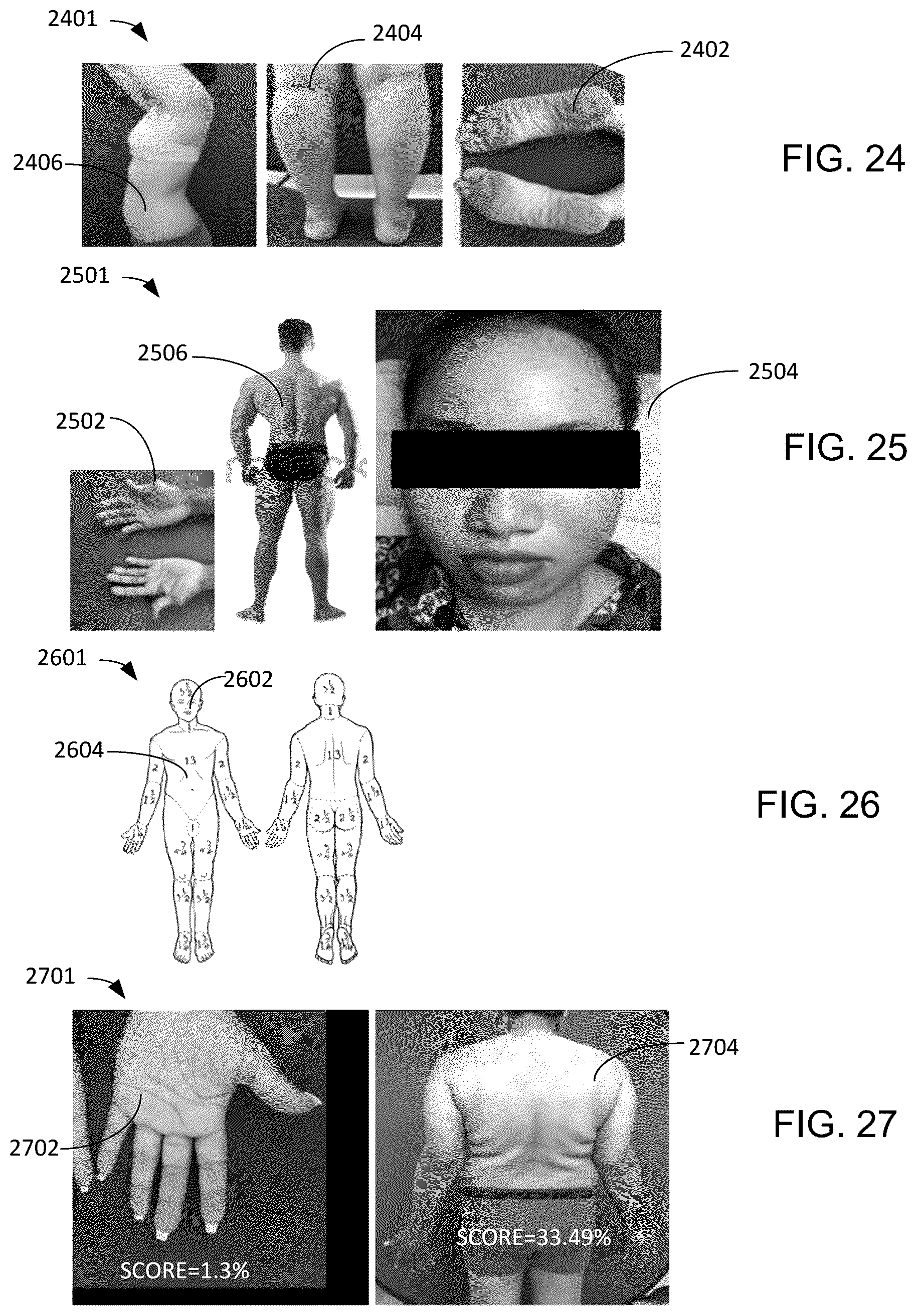 Patent US12100152 Figure 13 – Compute system with acne diagnostic mechanism and method of operation thereof