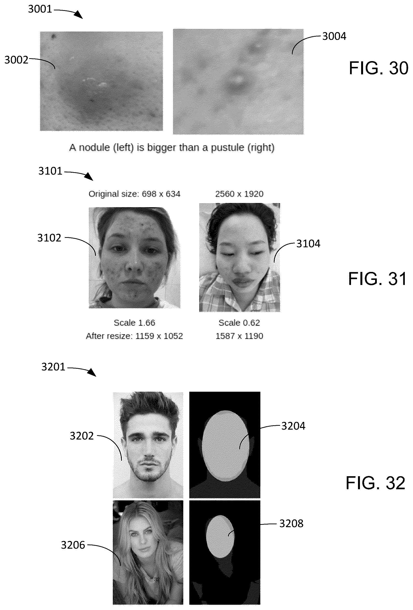 Patent US12100152 Figure 15 – Compute system with acne diagnostic mechanism and method of operation thereof