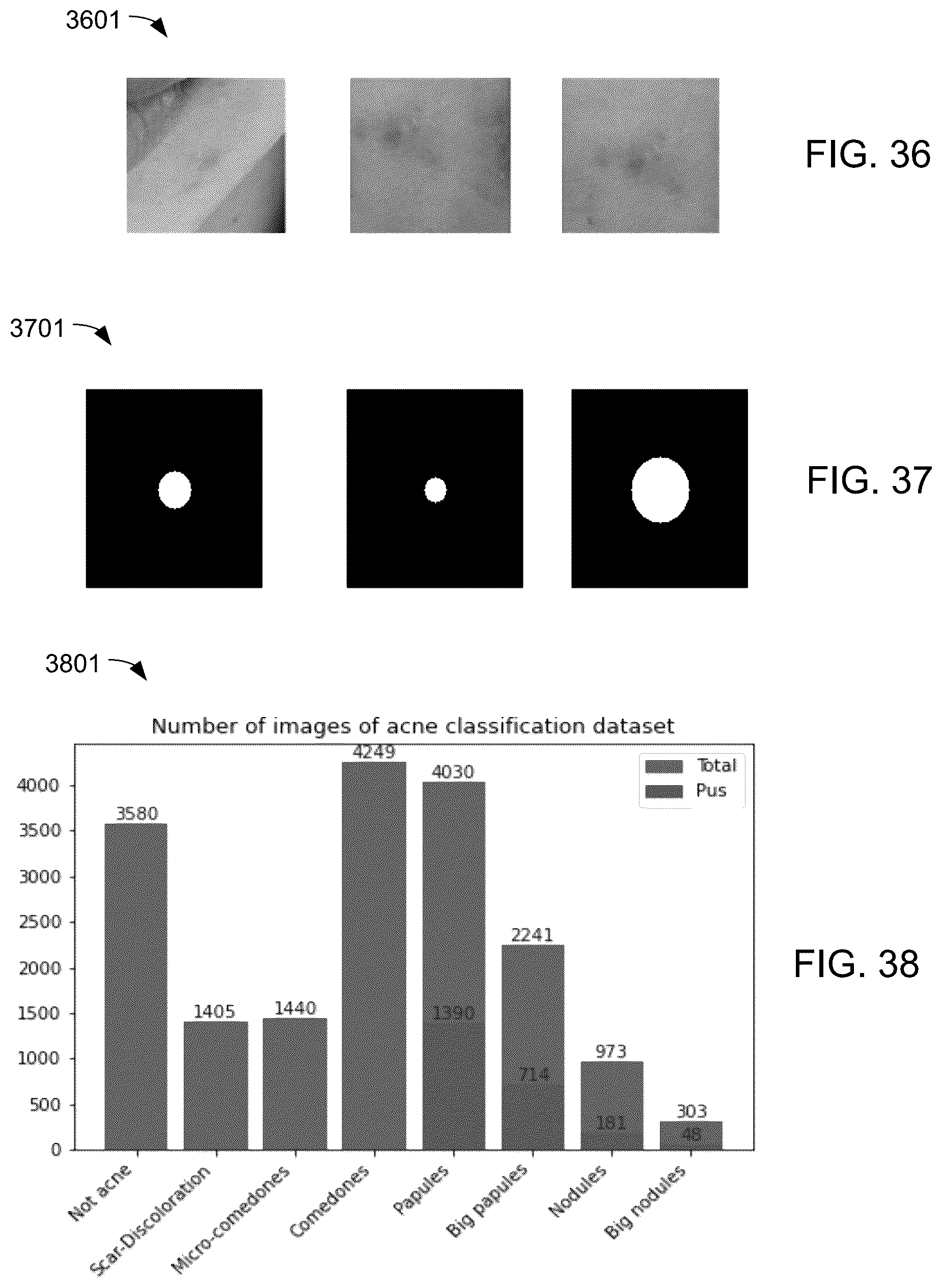 Patent US12100152 Figure 17 – Compute system with acne diagnostic mechanism and method of operation thereof