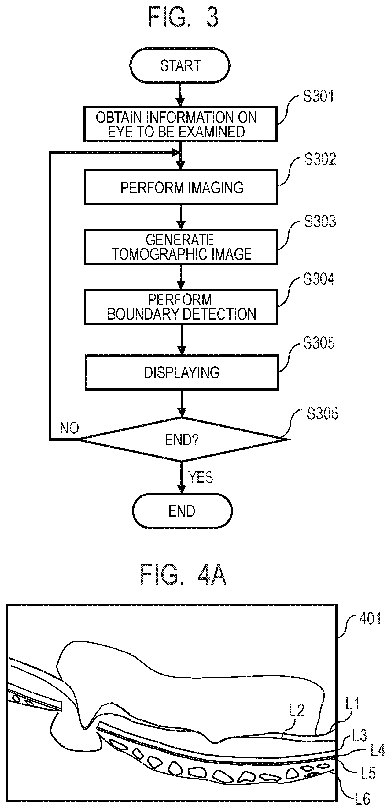 Patent US12100154 Figure 3 – Medical image processing apparatus, medical image processing method, computer-readable medium, and learned model