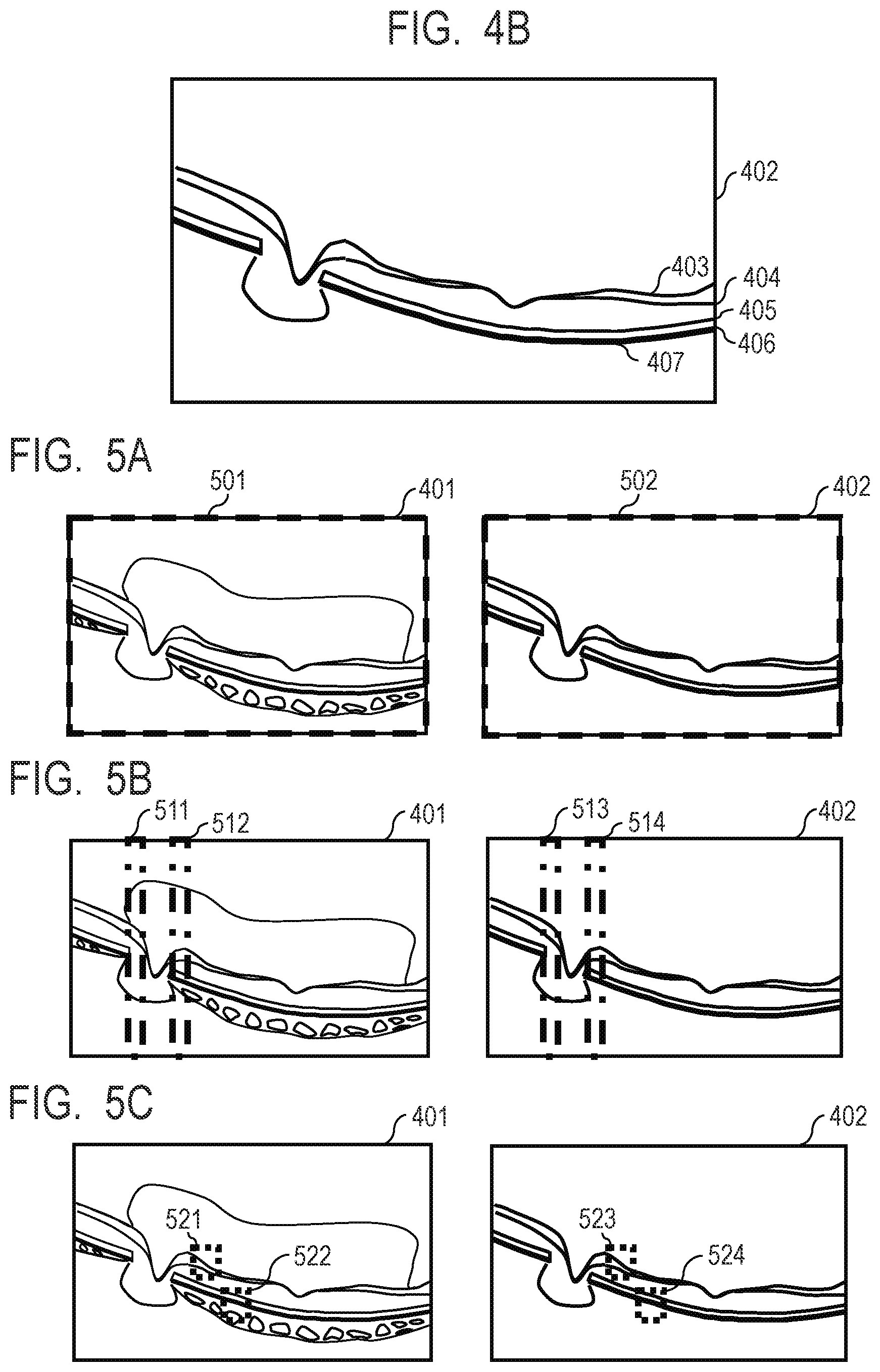 Patent US12100154 Figure 4 – Medical image processing apparatus, medical image processing method, computer-readable medium, and learned model