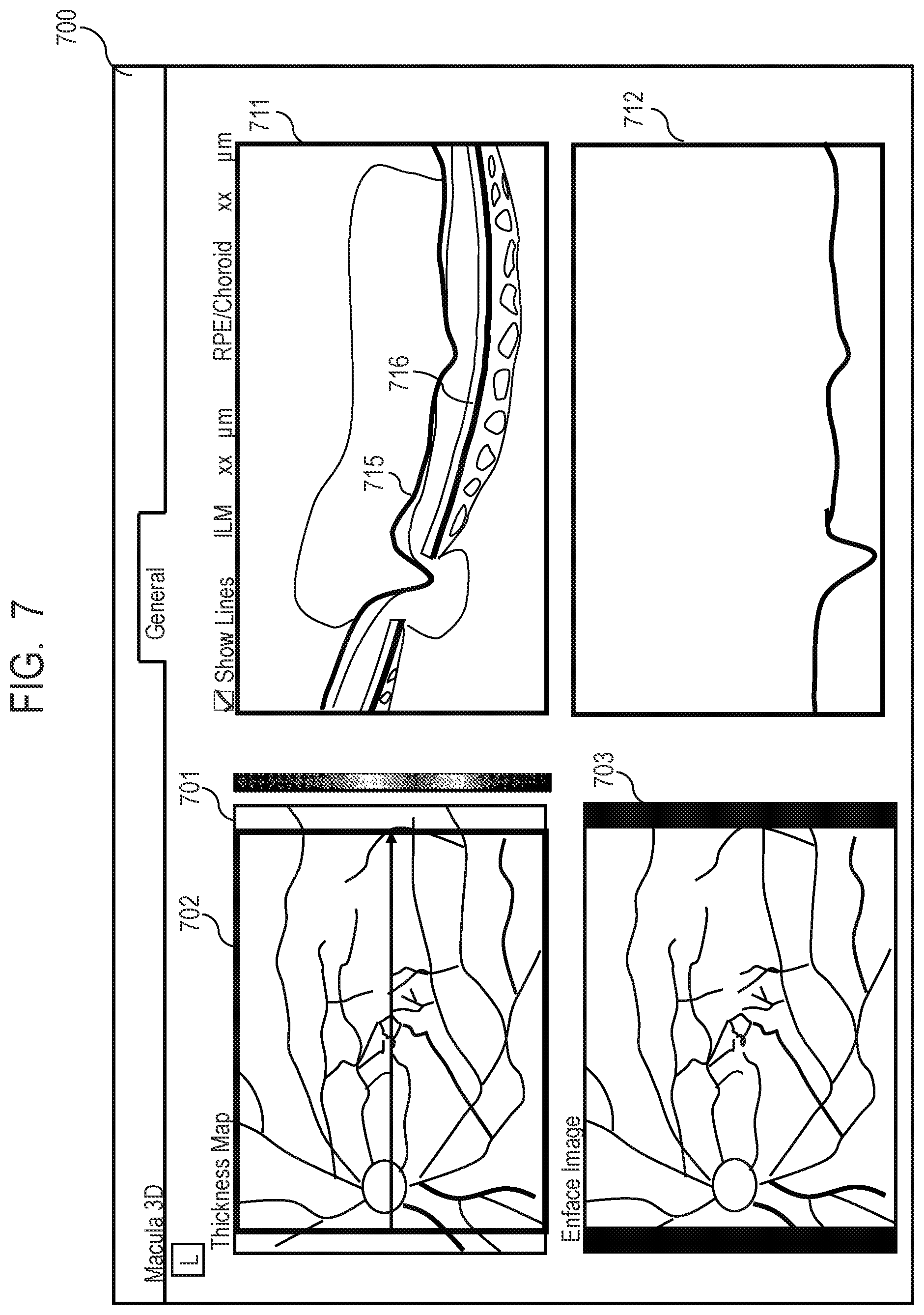 Patent US12100154 Figure 6 – Medical image processing apparatus, medical image processing method, computer-readable medium, and learned model