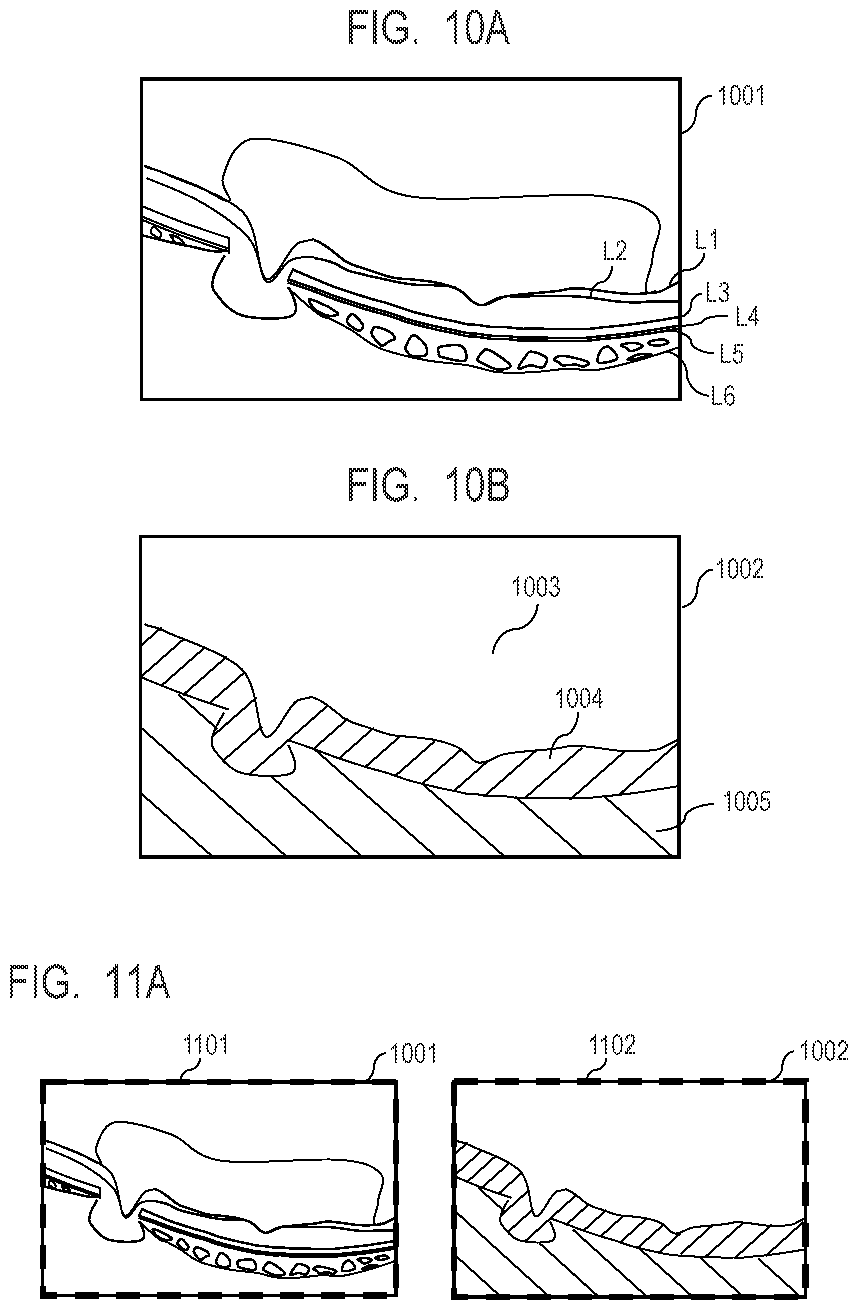 Patent US12100154 Figure 9 – Medical image processing apparatus, medical image processing method, computer-readable medium, and learned model