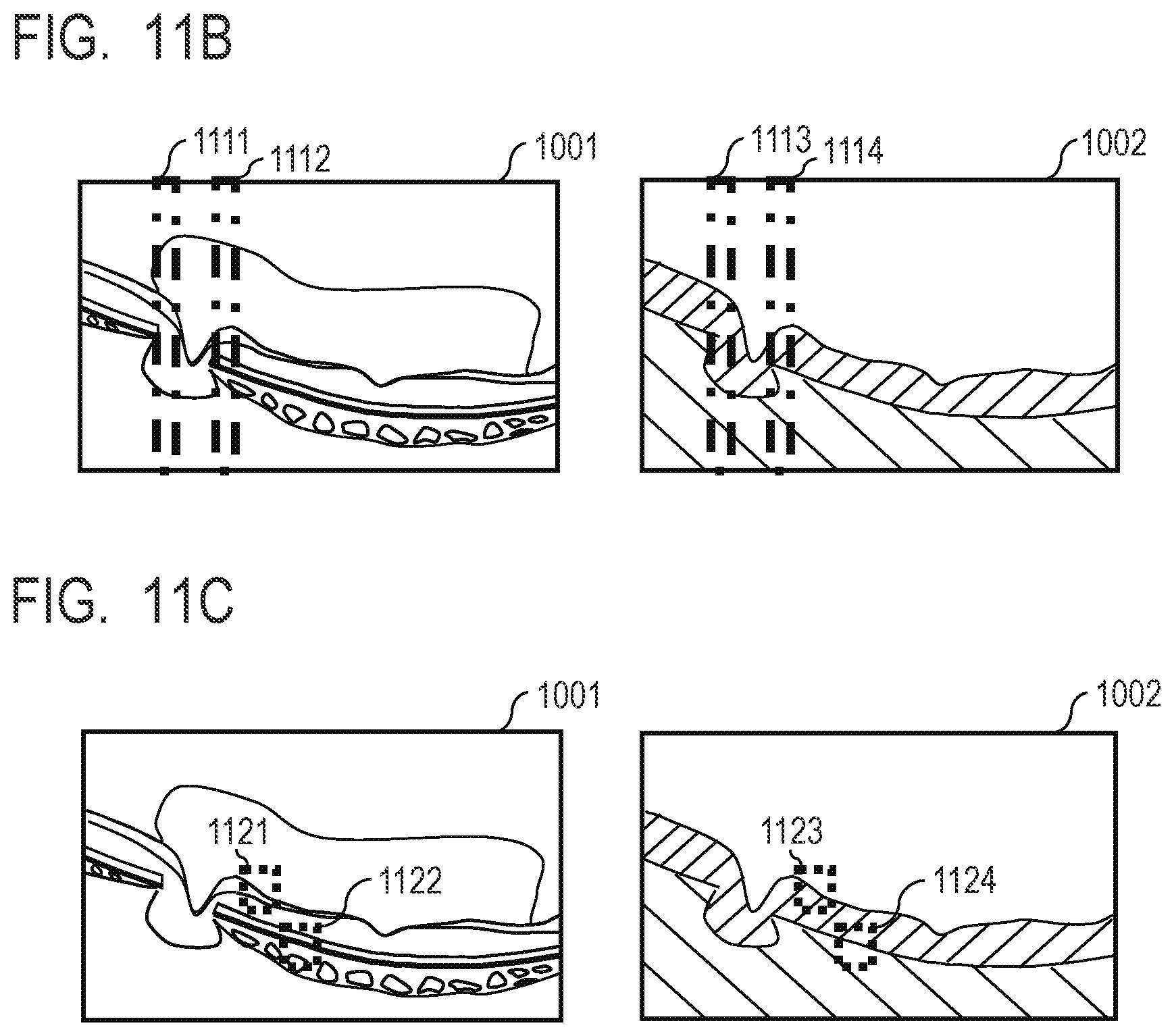 Patent US12100154 Figure 10 – Medical image processing apparatus, medical image processing method, computer-readable medium, and learned model