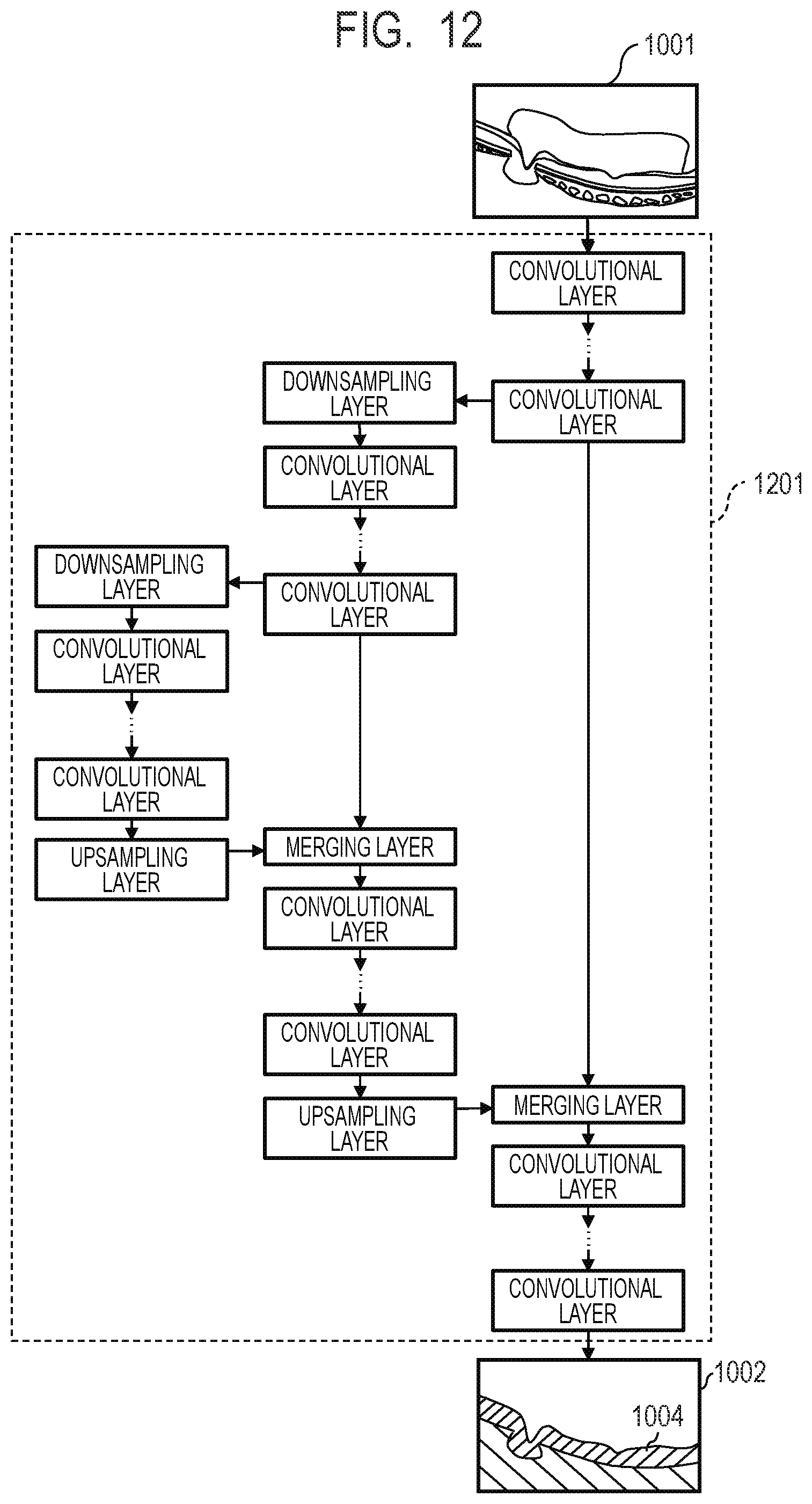 Patent US12100154 Figure 11 – Medical image processing apparatus, medical image processing method, computer-readable medium, and learned model