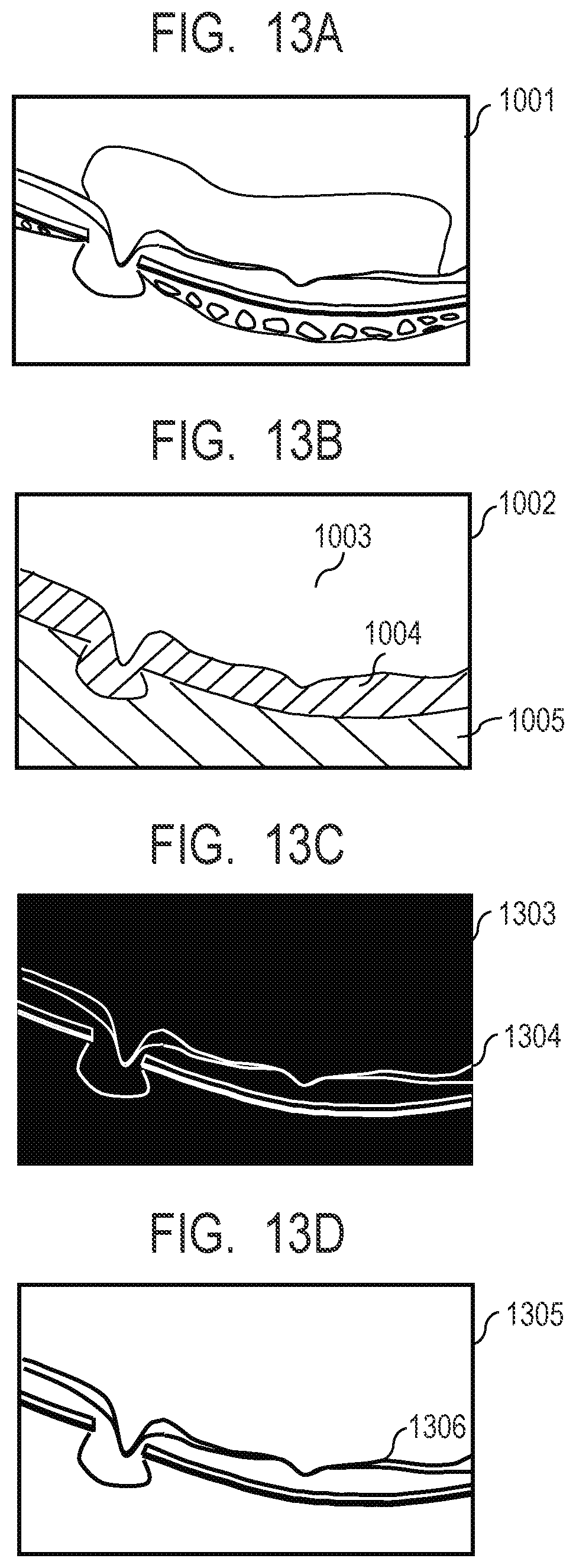 Patent US12100154 Figure 12 – Medical image processing apparatus, medical image processing method, computer-readable medium, and learned model
