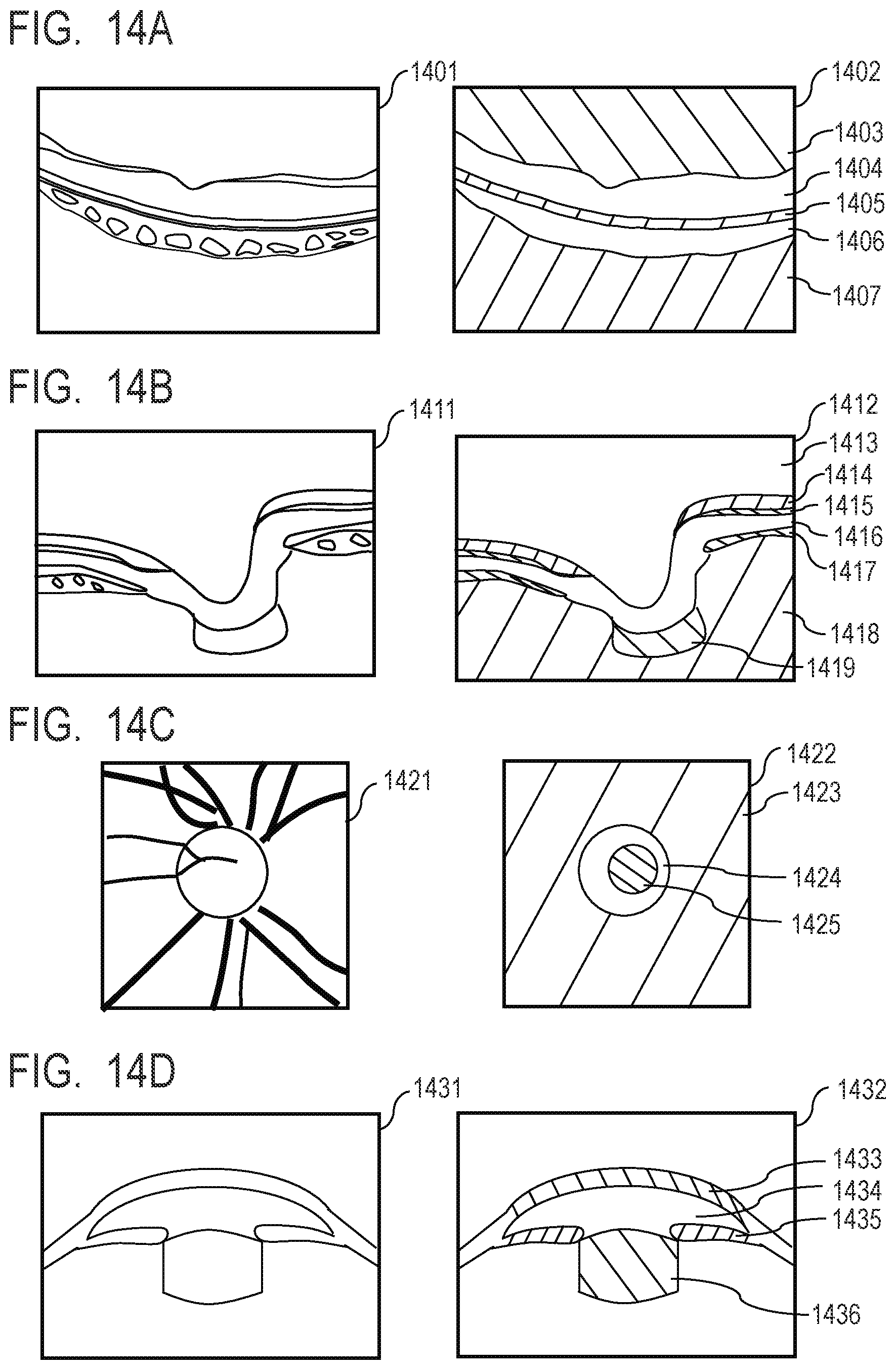Patent US12100154 Figure 13 – Medical image processing apparatus, medical image processing method, computer-readable medium, and learned model