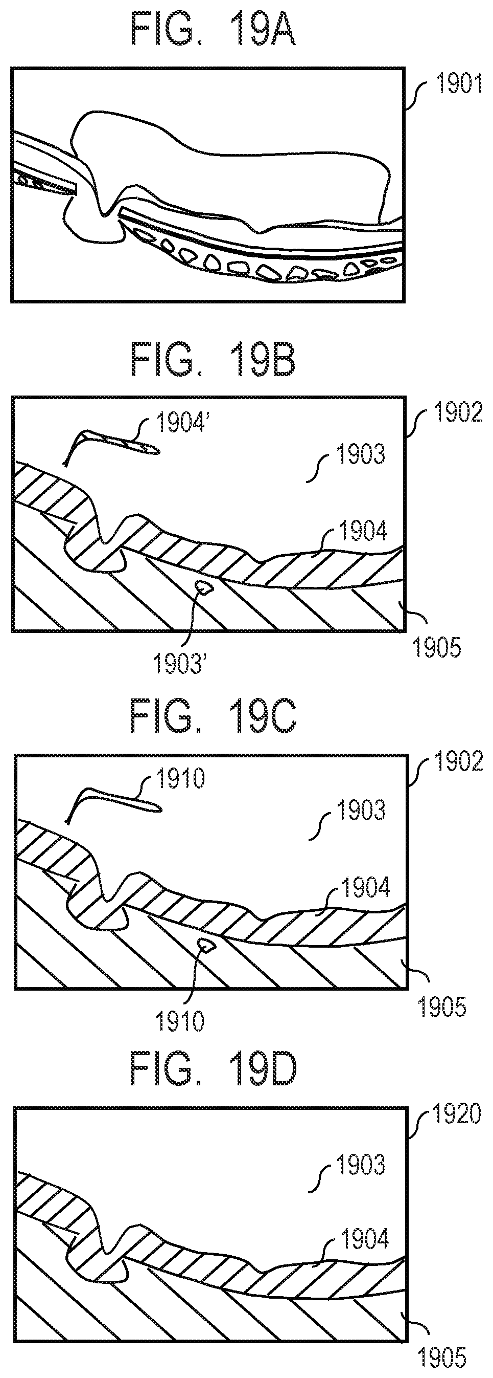 Patent US12100154 Figure 19 – Medical image processing apparatus, medical image processing method, computer-readable medium, and learned model