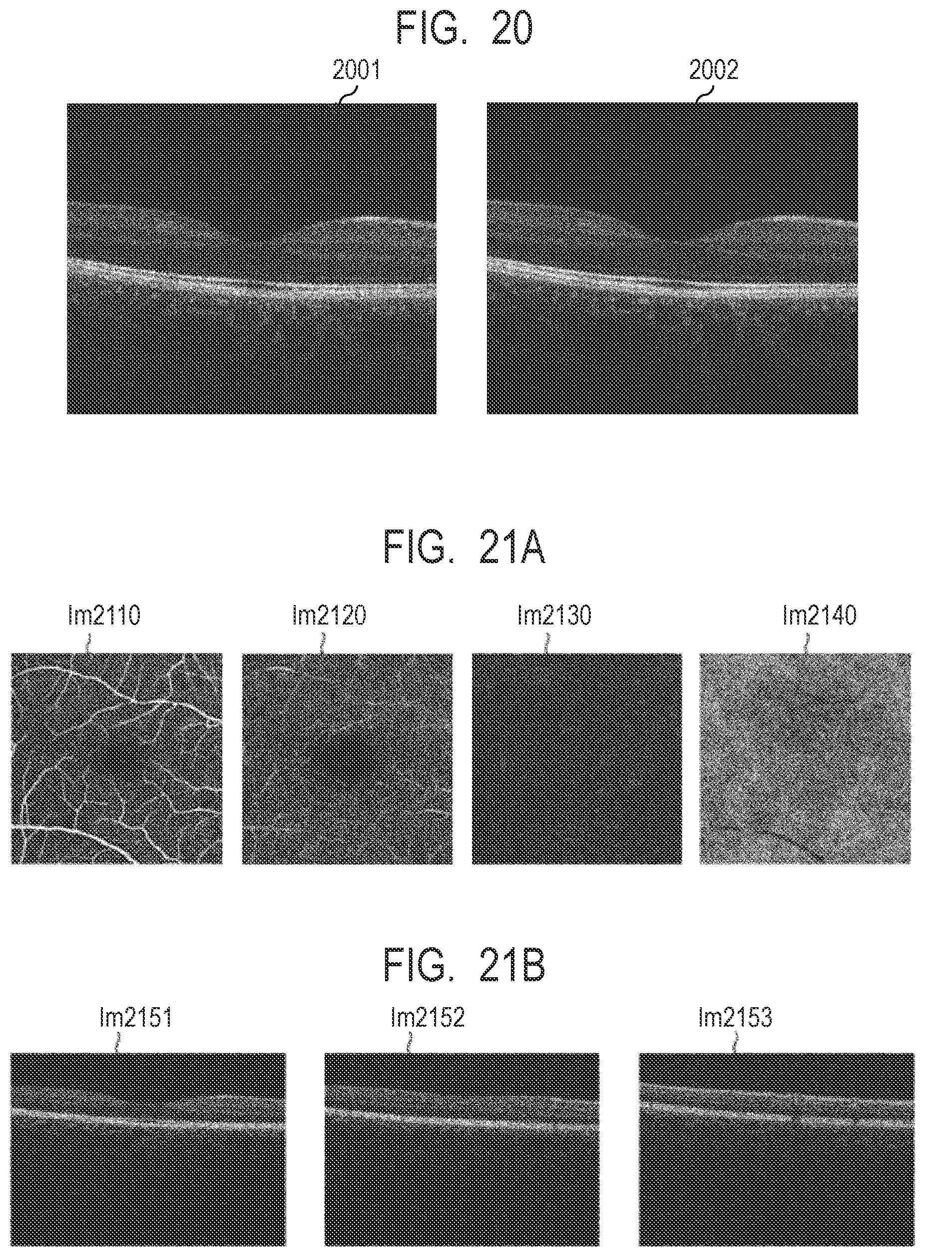 Patent US12100154 Figure 20 – Medical image processing apparatus, medical image processing method, computer-readable medium, and learned model