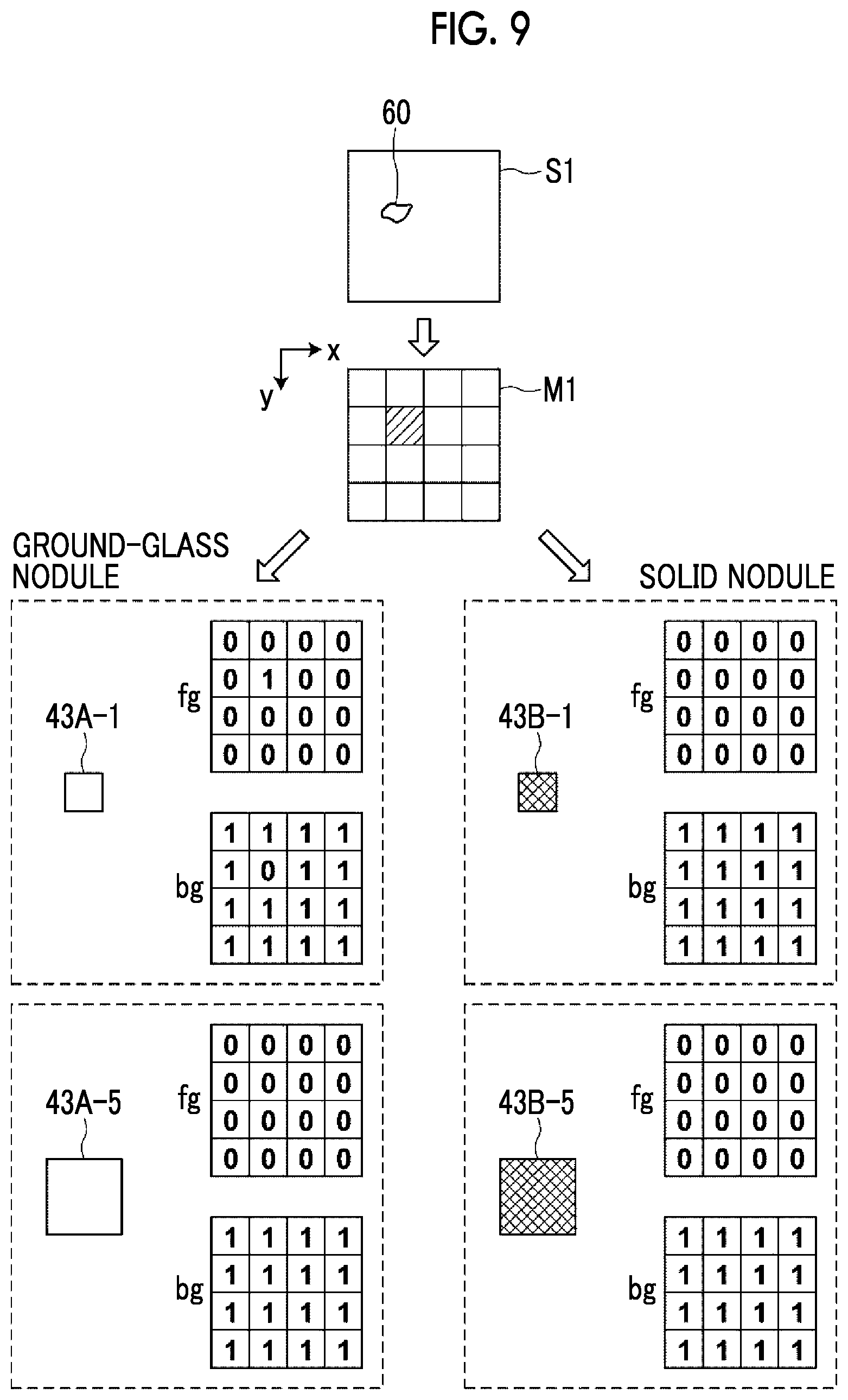 Patent US12100155 Figure 8 – Region specification apparatus, region specification method, region specification program, learning apparatus, learning method, learning program, and discriminator