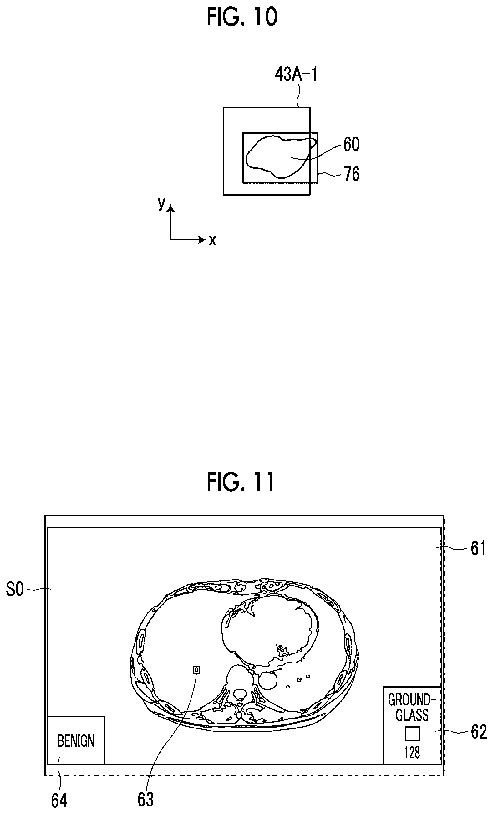 Patent US12100155 Figure 9 – Region specification apparatus, region specification method, region specification program, learning apparatus, learning method, learning program, and discriminator