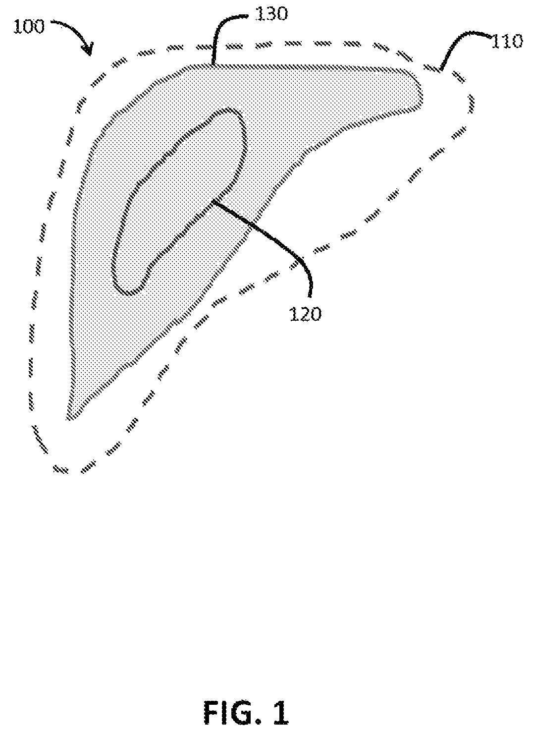 Patent US12100161 Figure 1 – Organ segmentation method and system
