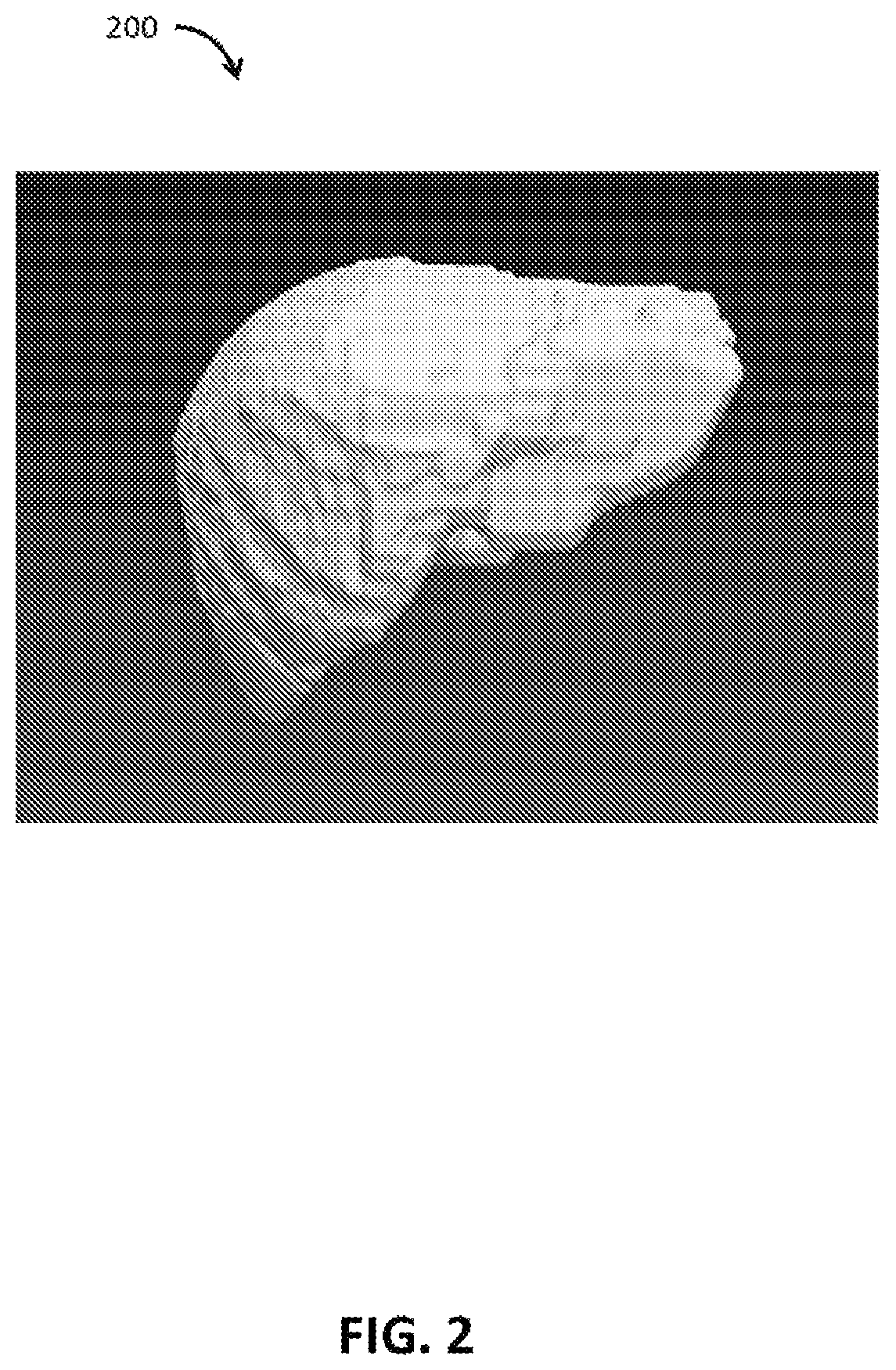 Patent US12100161 Figure 2 – Organ segmentation method and system