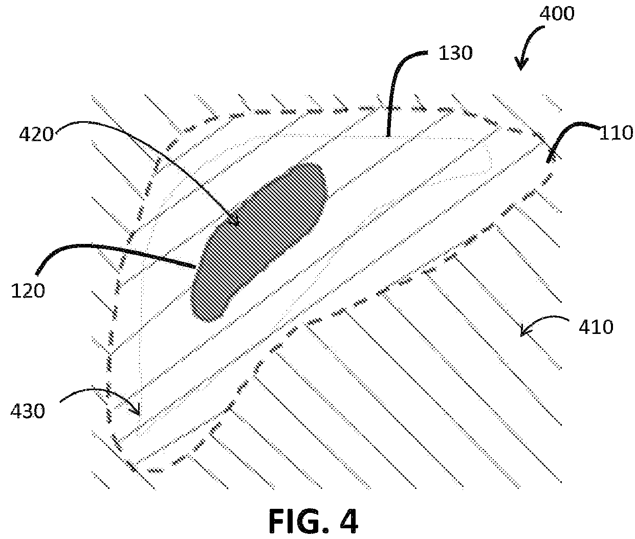 Patent US12100161 Figure 4 – Organ segmentation method and system