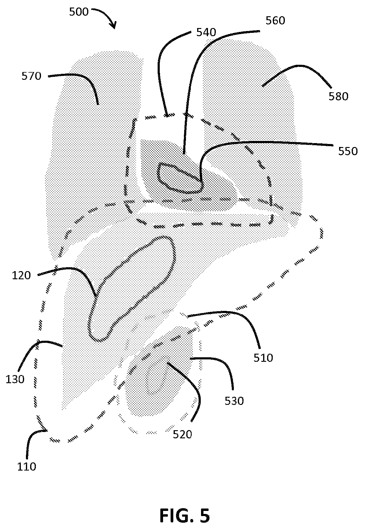 Patent US12100161 Figure 5 – Organ segmentation method and system