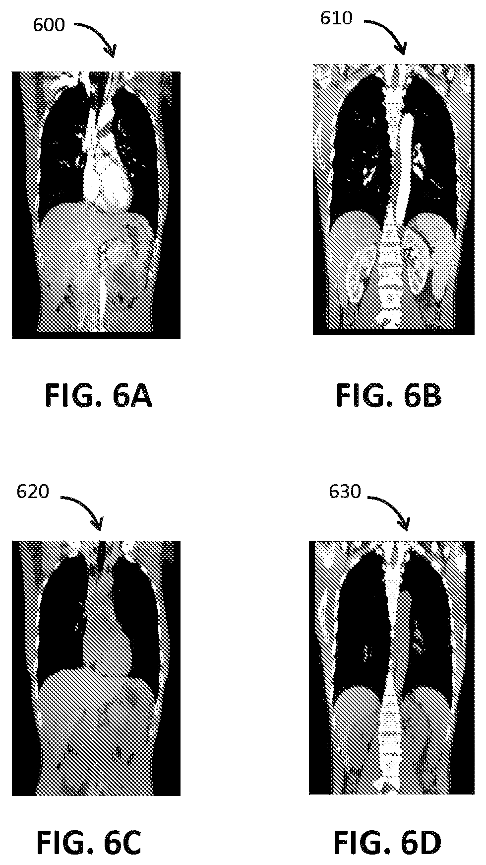 Patent US12100161 Figure 6 – Organ segmentation method and system