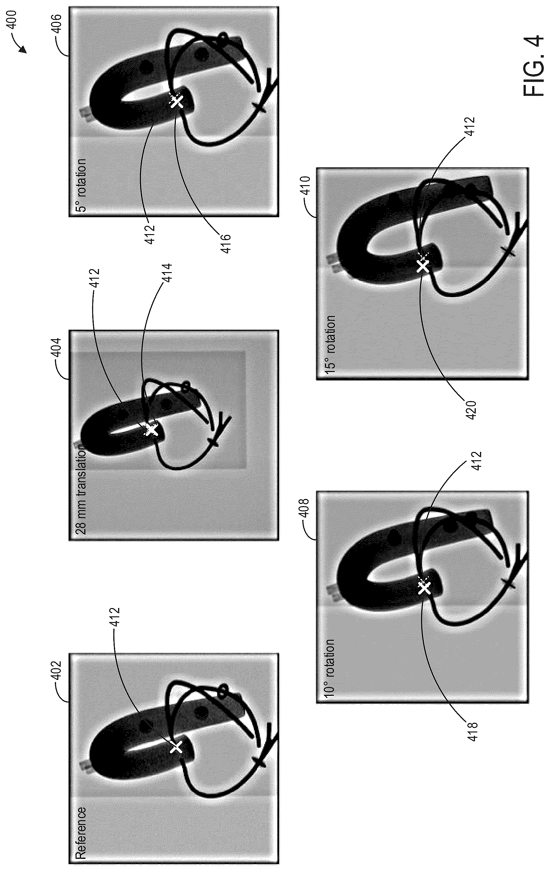 Patent US12100174 Figure 4 – Methods and system for dynamically annotating medical images