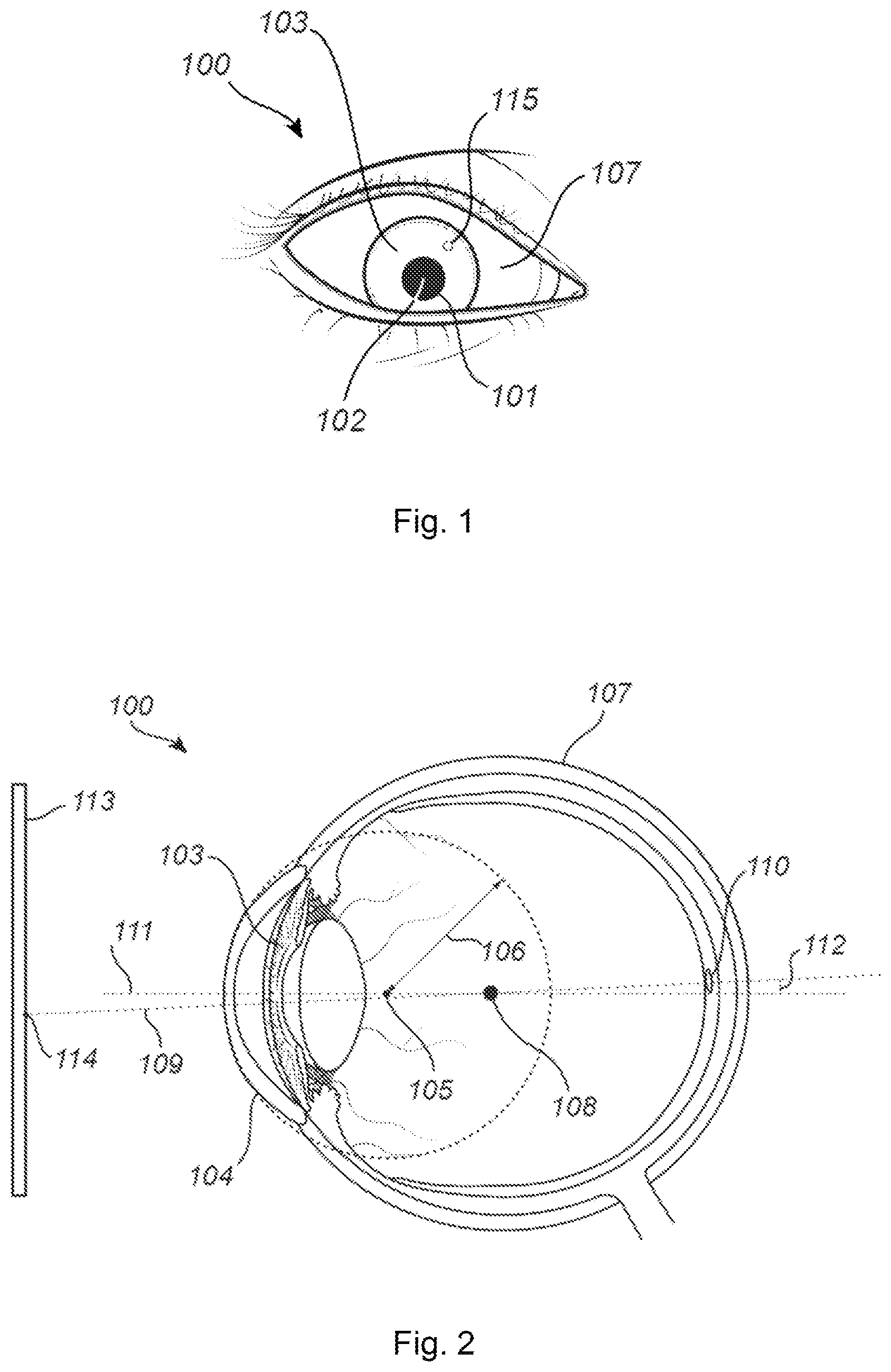 Patent US12100176 Figure 1 – Calibration of an eye tracking system