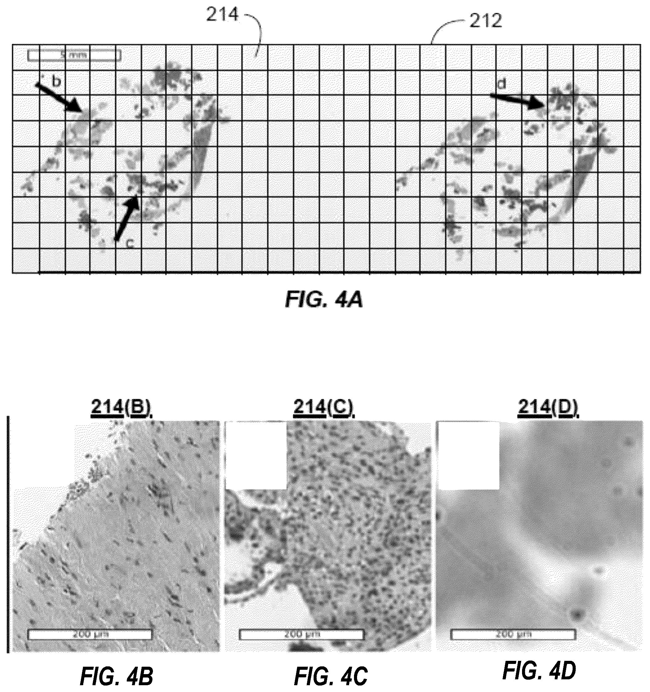 Patent US12100191 Figure 7 – System, method and computer-accessible medium for quantification of blur in digital images