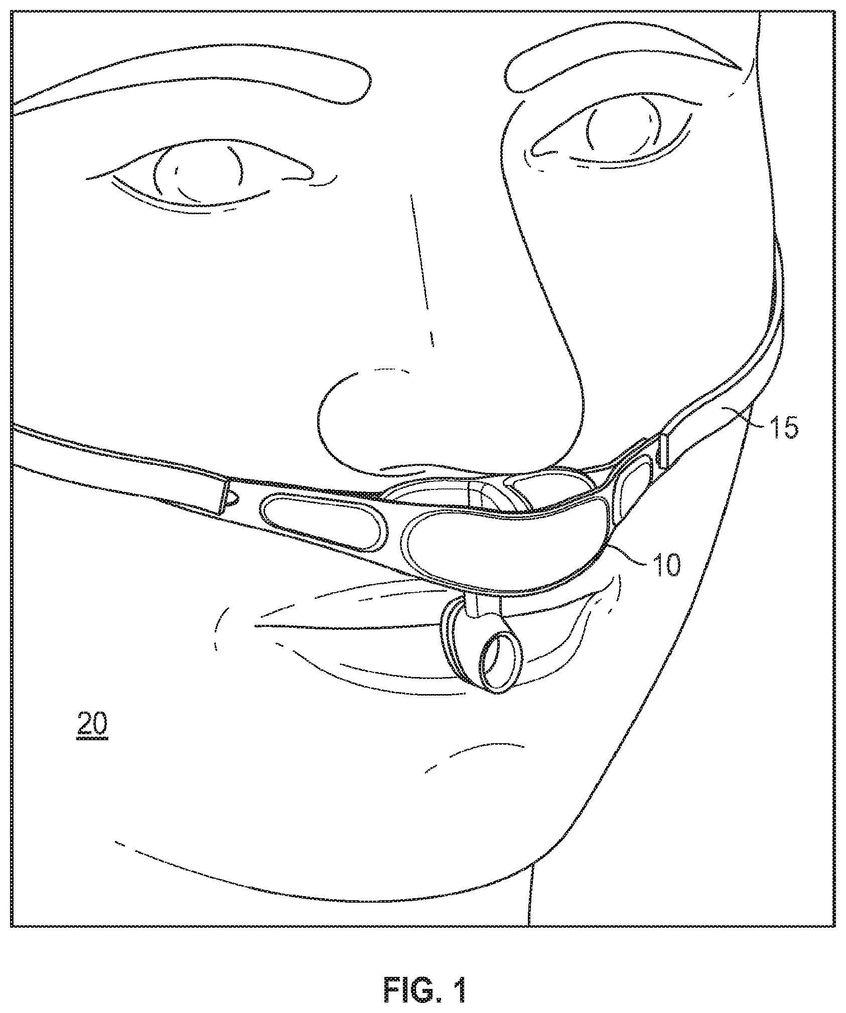 Patent US12100492 Figure 1 – Nasal and oral respiration sensor