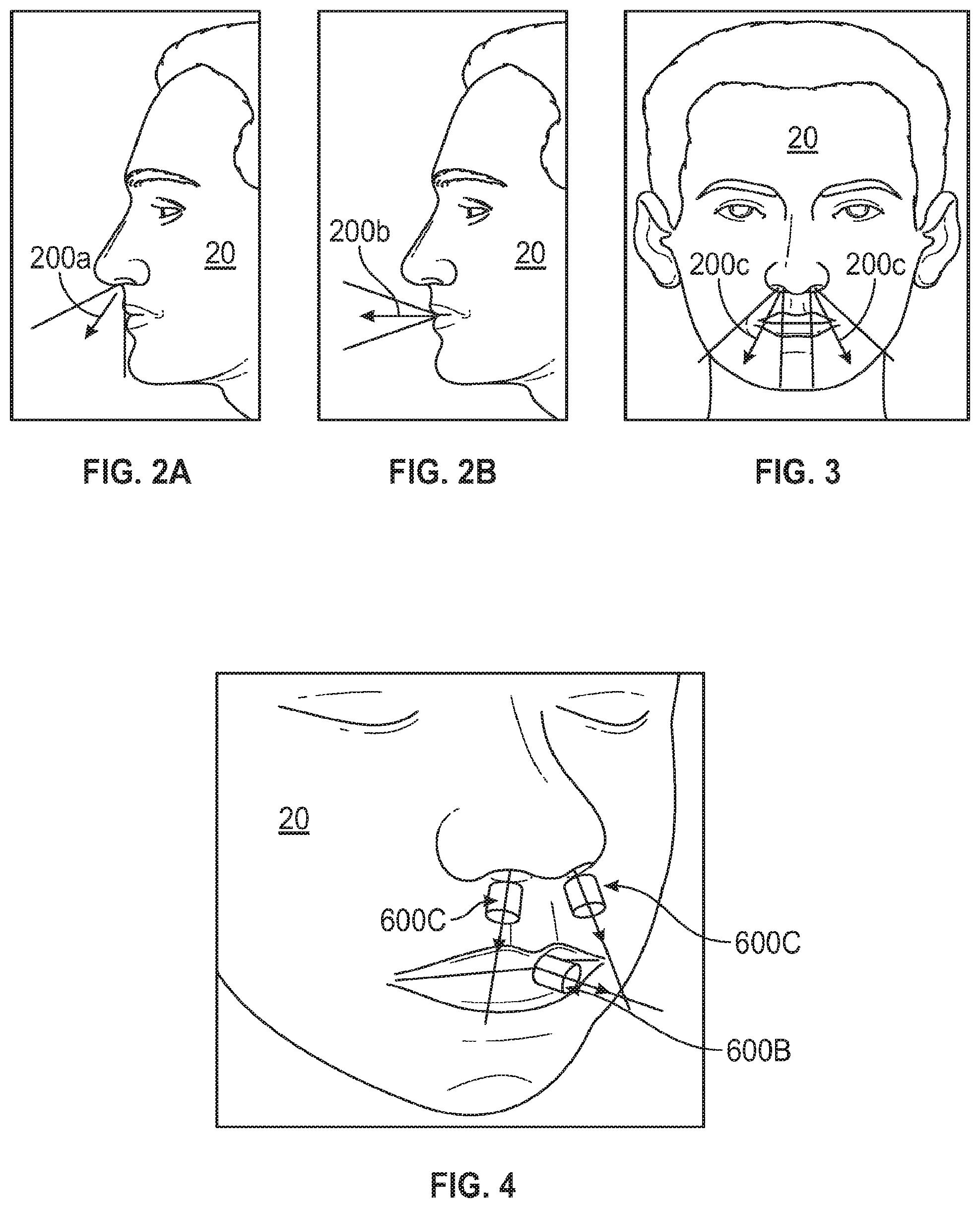 Patent US12100492 Figure 2 – Nasal and oral respiration sensor