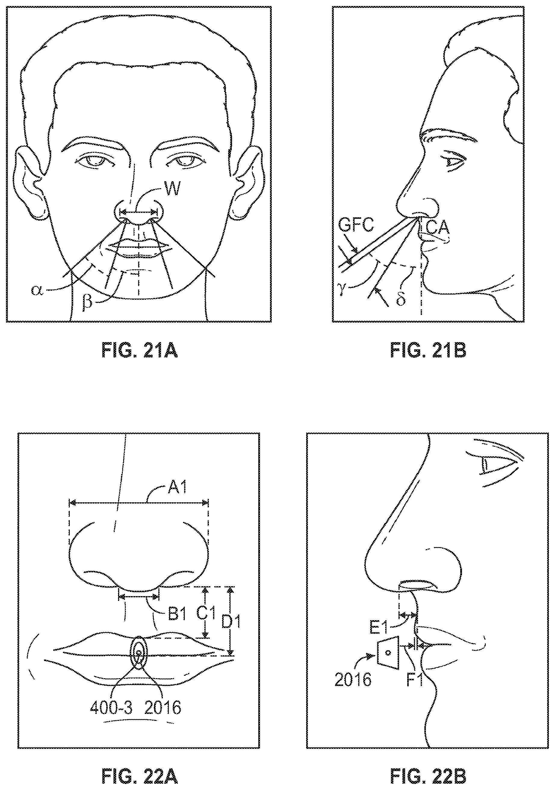 Patent US12100492 Figure 12 – Nasal and oral respiration sensor