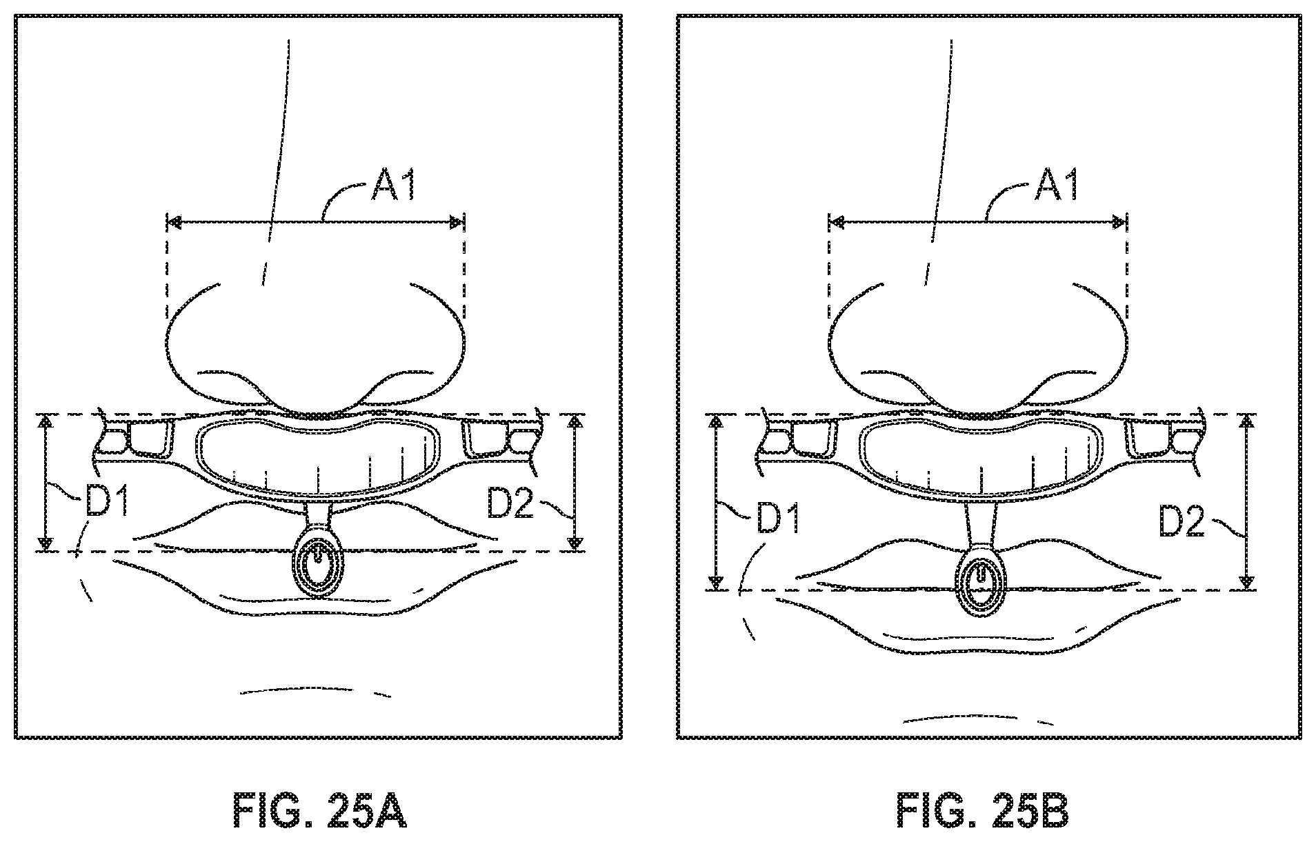 Patent US12100492 Figure 14 – Nasal and oral respiration sensor