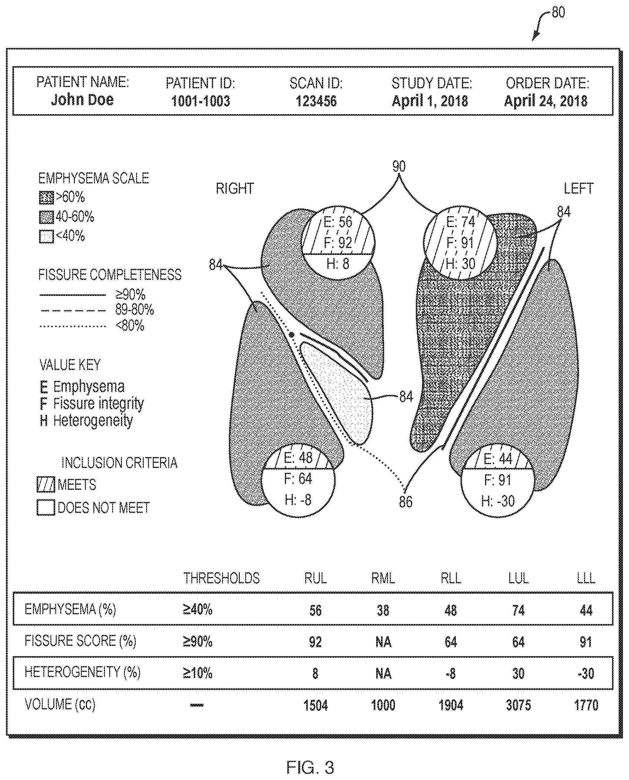 Patent US12100493 Figure 3 – Lung analysis and reporting system
